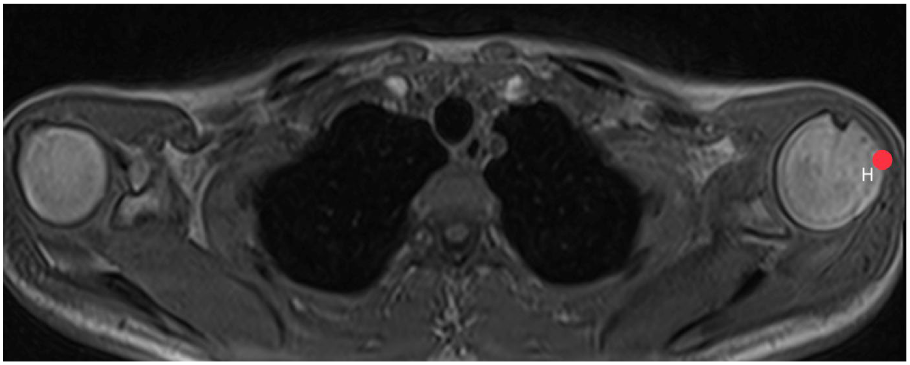 Diagnostics 14 00107 g004