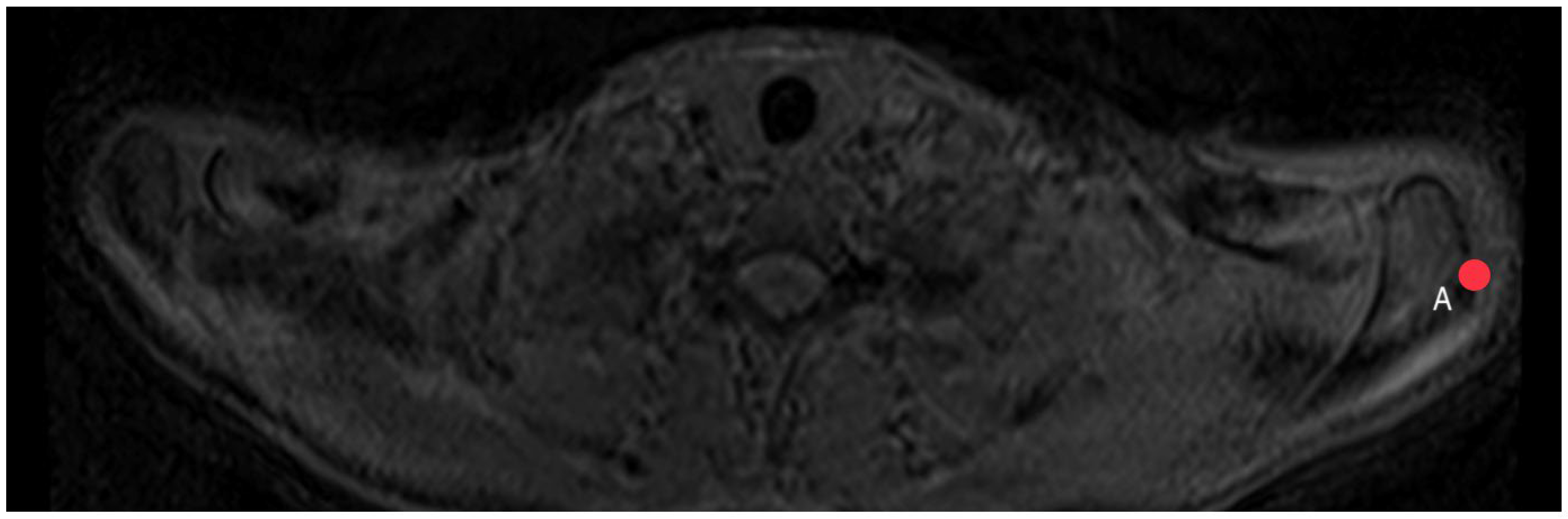 Diagnostics 14 00107 g005