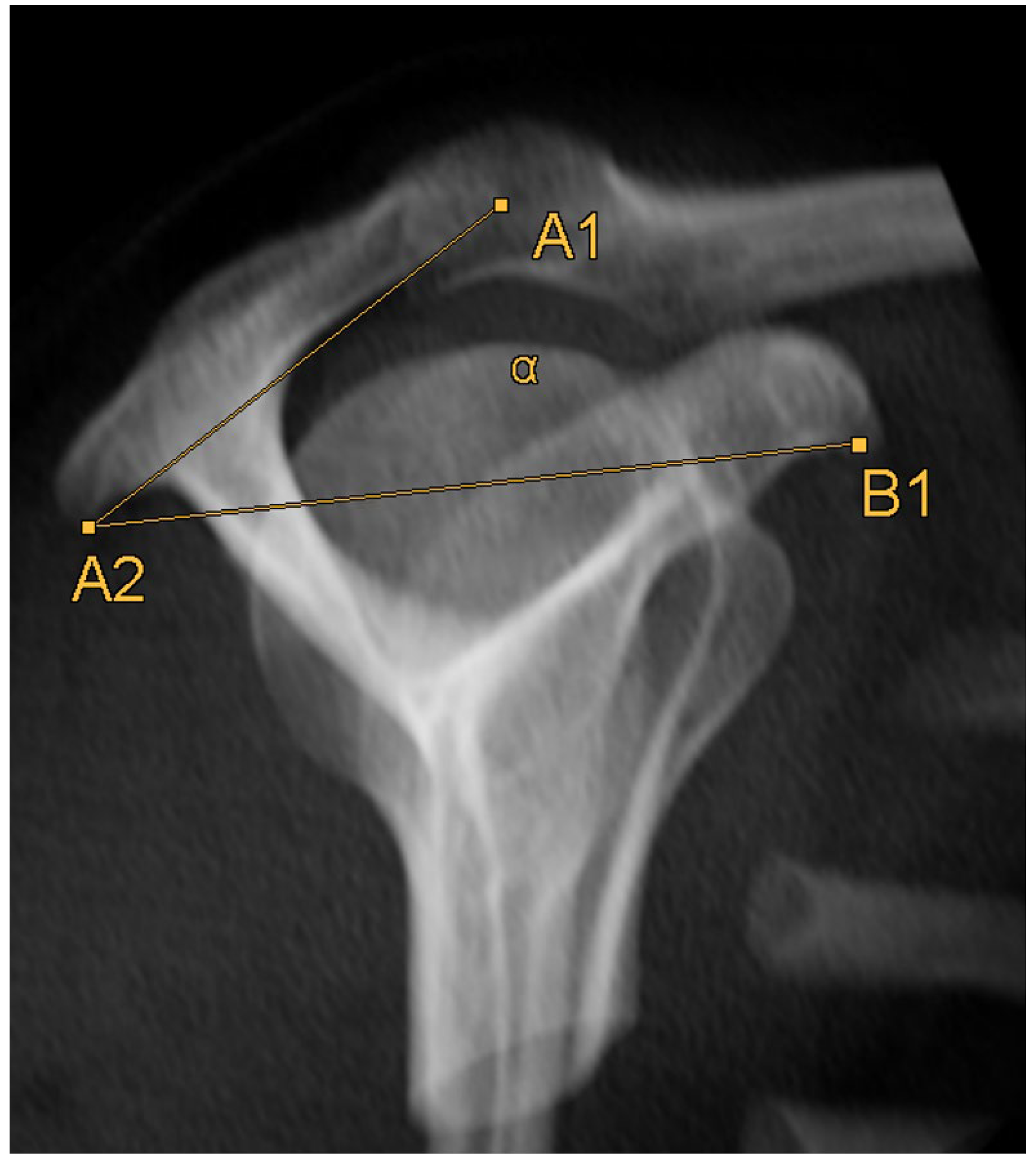 Diagnostics 14 00107 g006