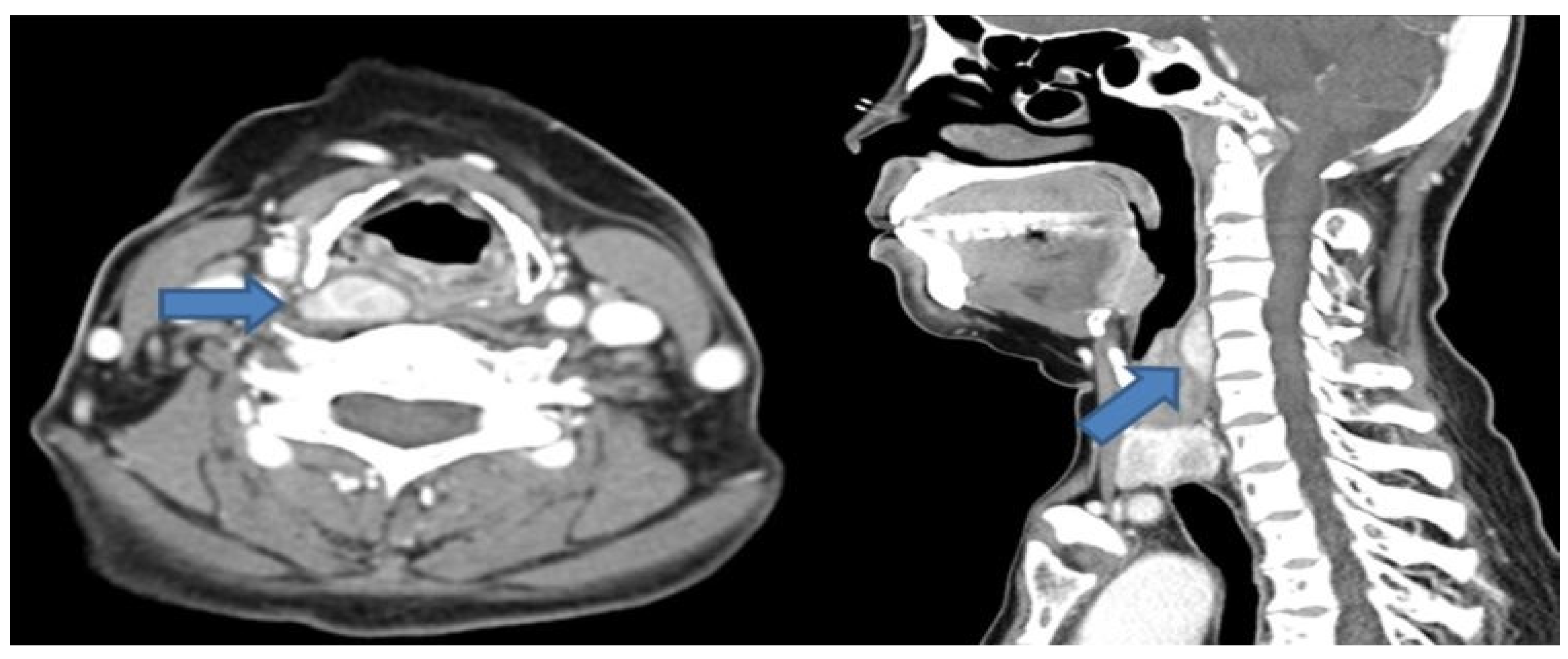 Diagnostics 14 00110 g001