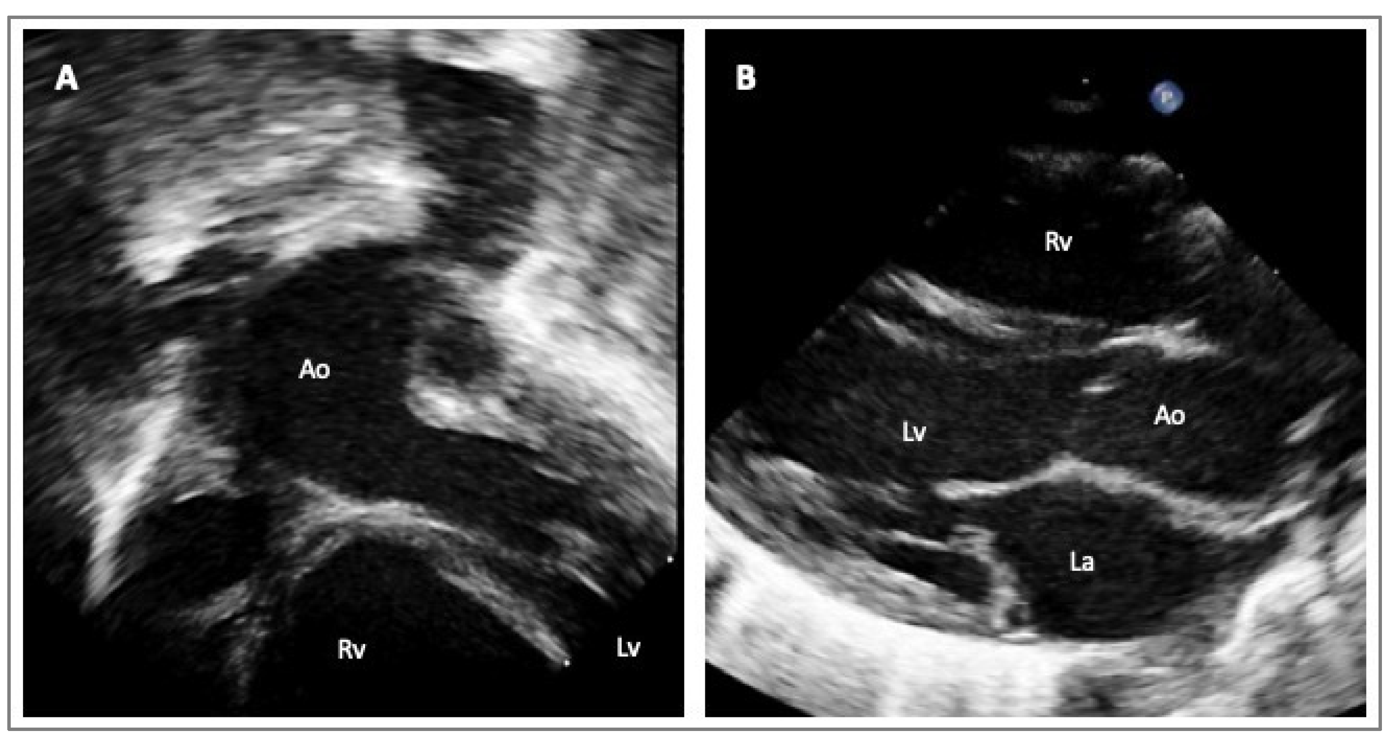 Diagnostics 14 00112 g002 Diagnostics 14 00112 g002