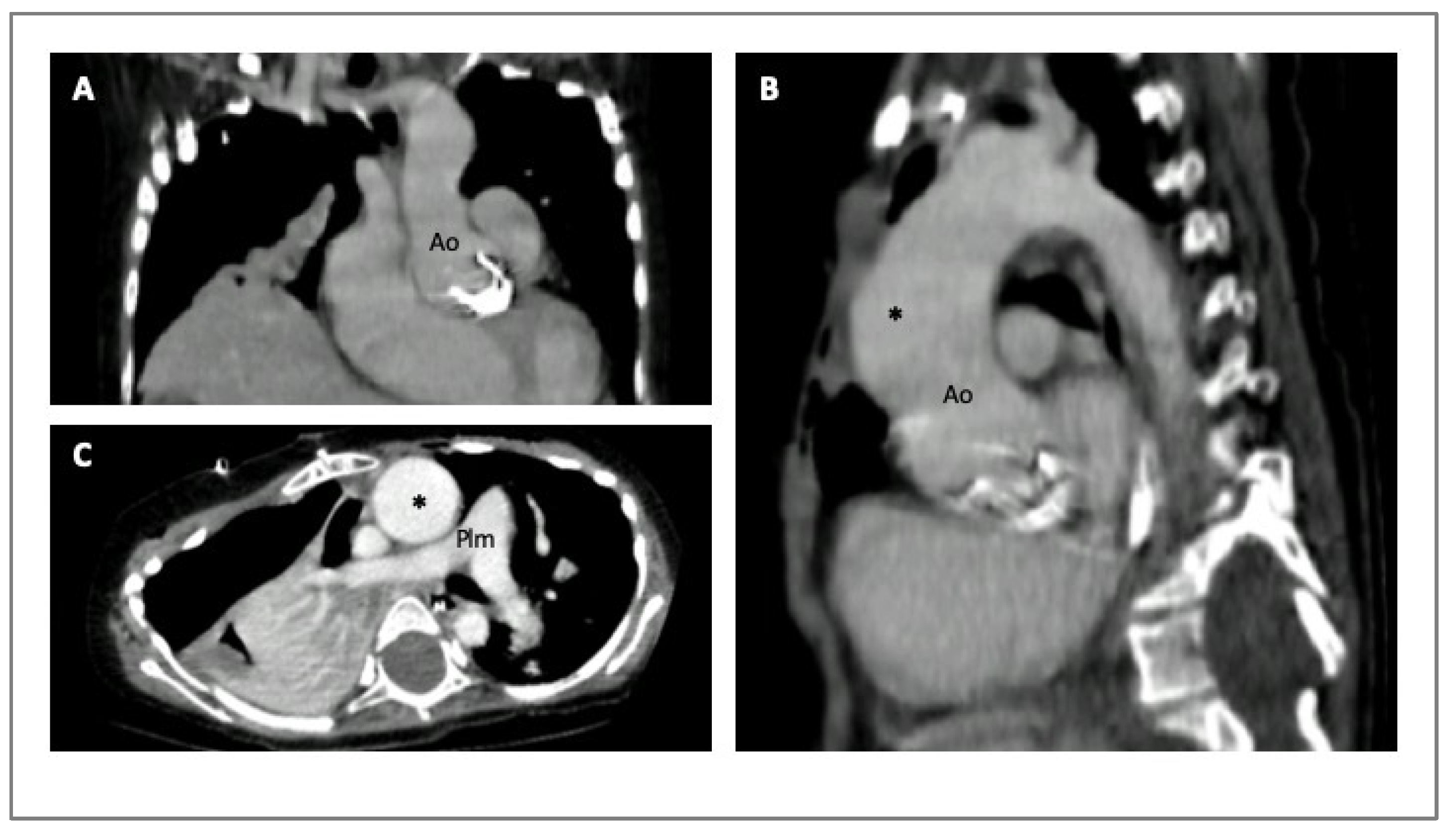 Diagnostics 14 00112 g003 Diagnostics 14 00112 g003