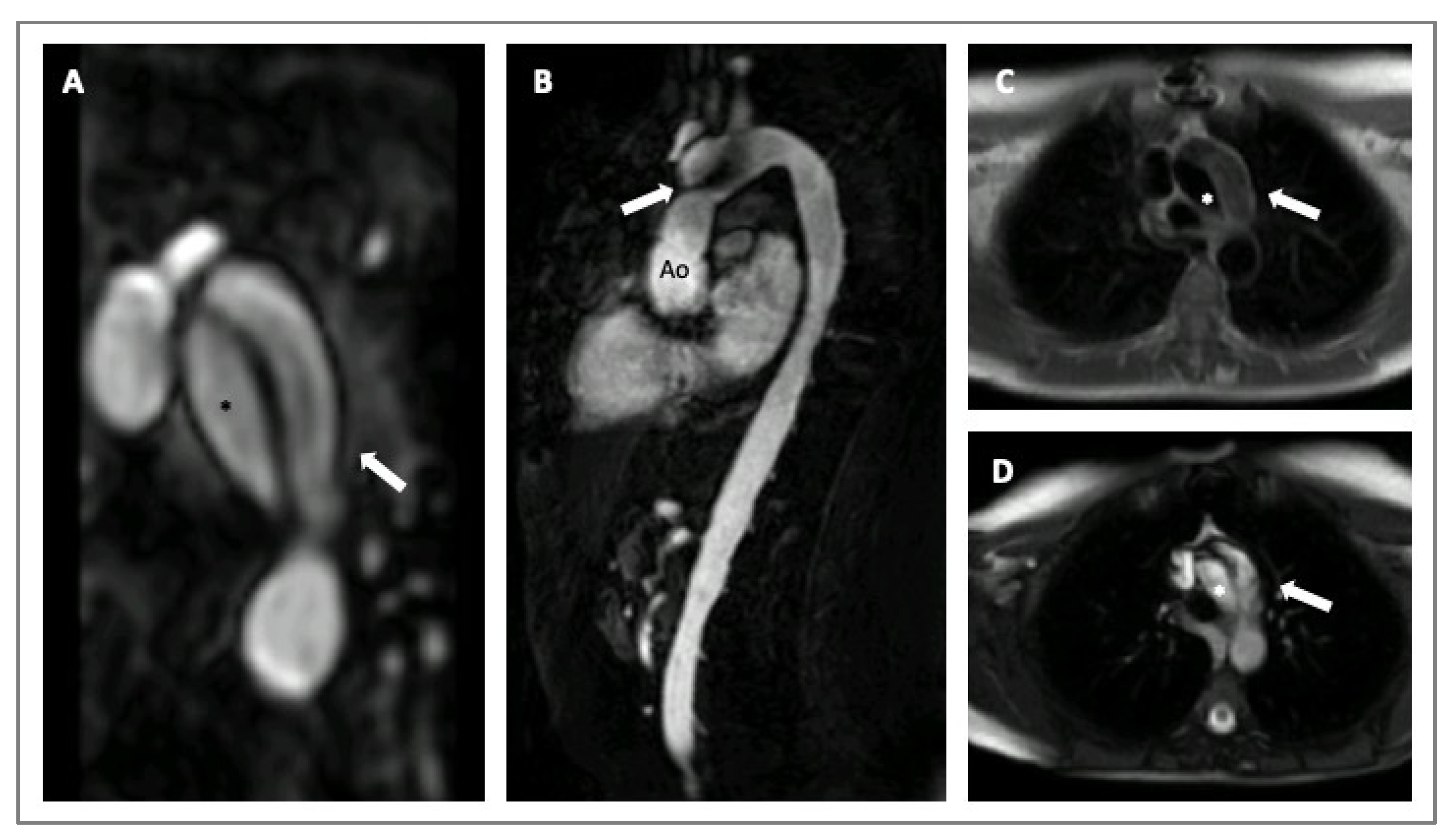 Diagnostics 14 00112 g004 Diagnostics 14 00112 g004