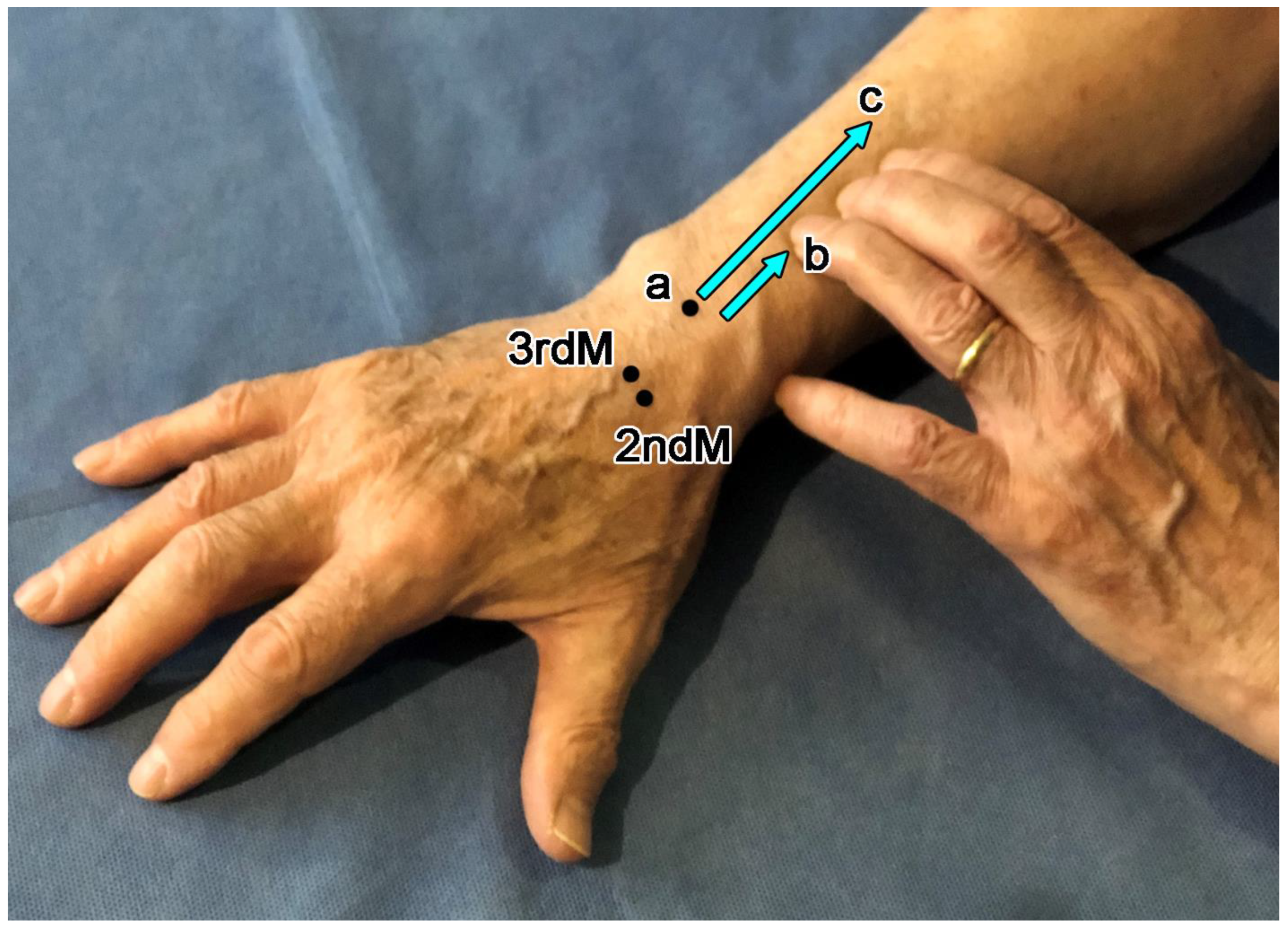 Diagnostics 14 00116 g001