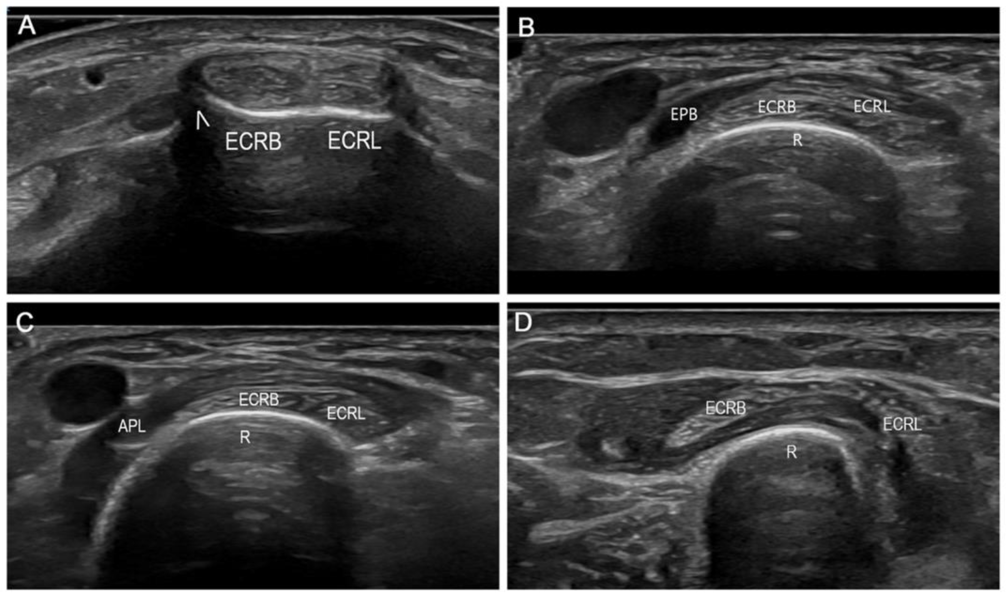 Diagnostics 14 00116 g002