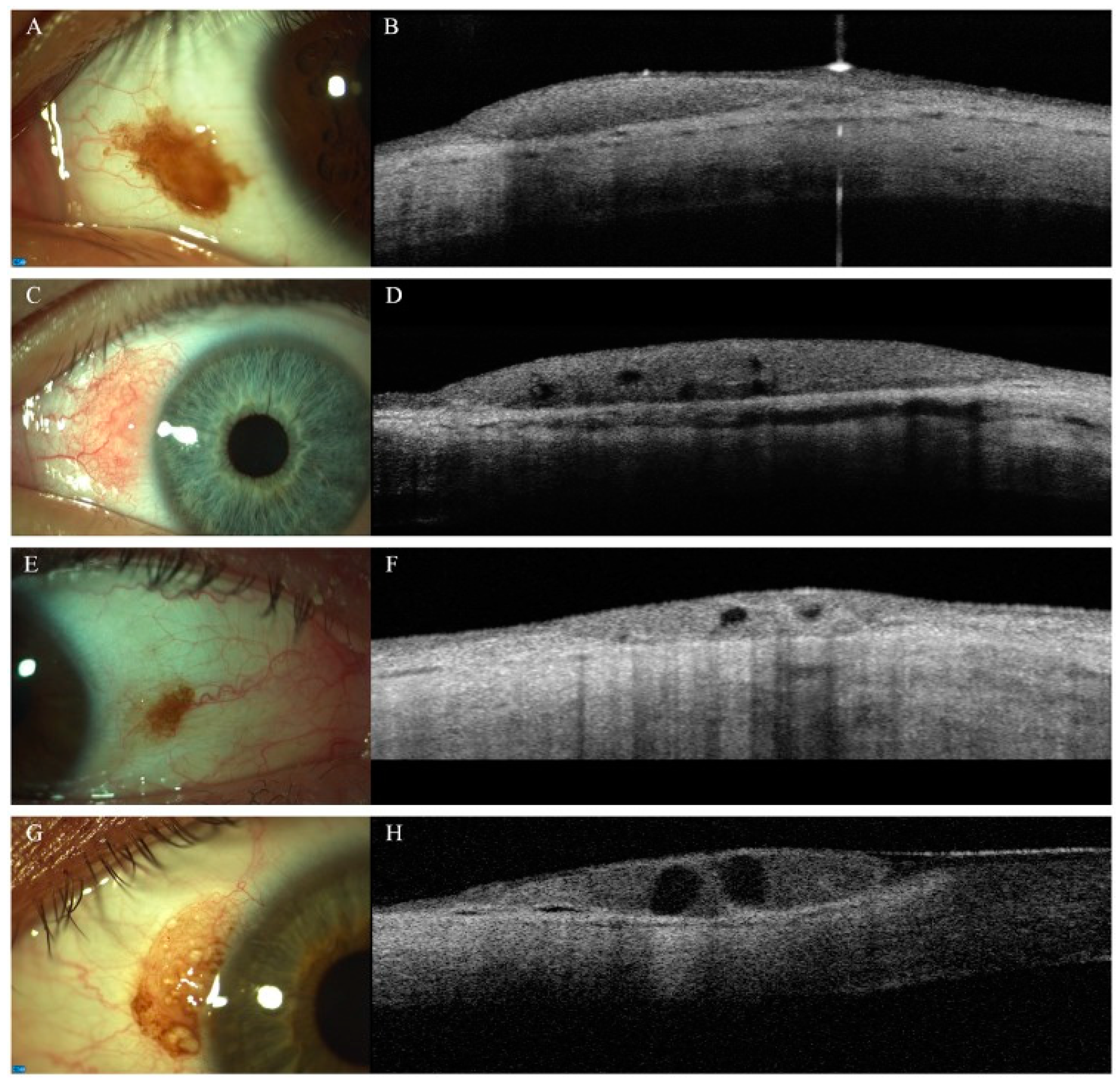 Diagnostics 14 00122 g003 Diagnostics 14 00122 g003