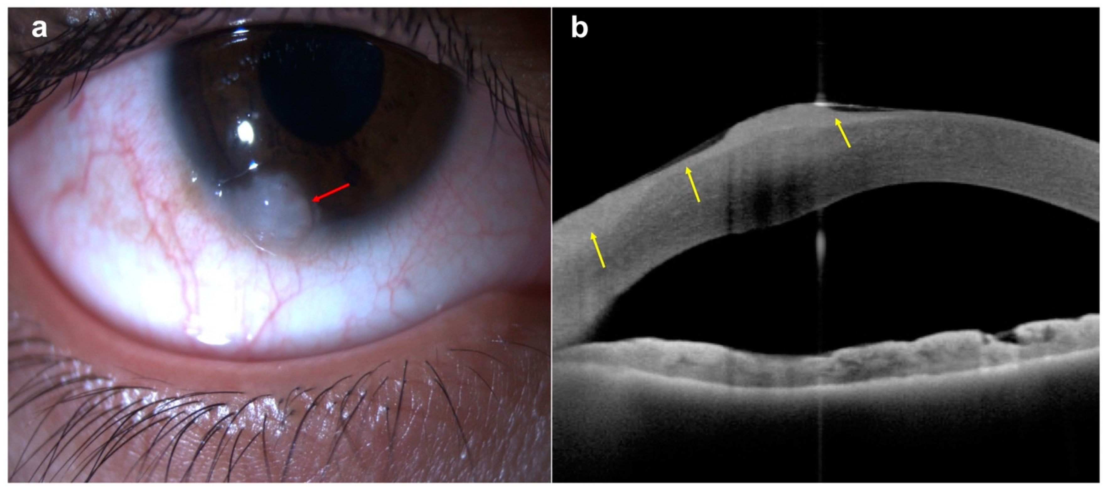 Diagnostics 14 00122 g004 Diagnostics 14 00122 g004