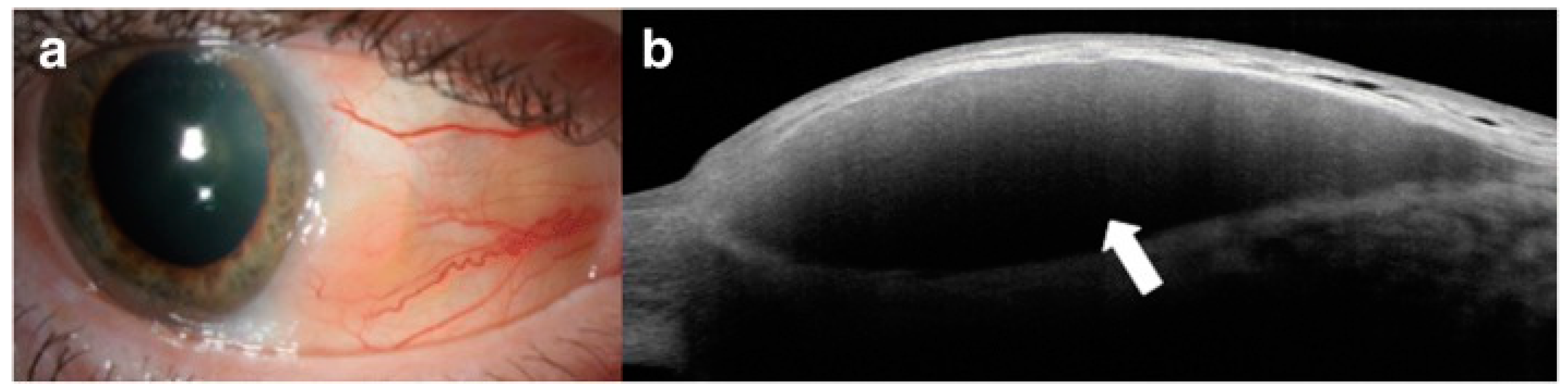 Diagnostics 14 00122 g005 Diagnostics 14 00122 g005