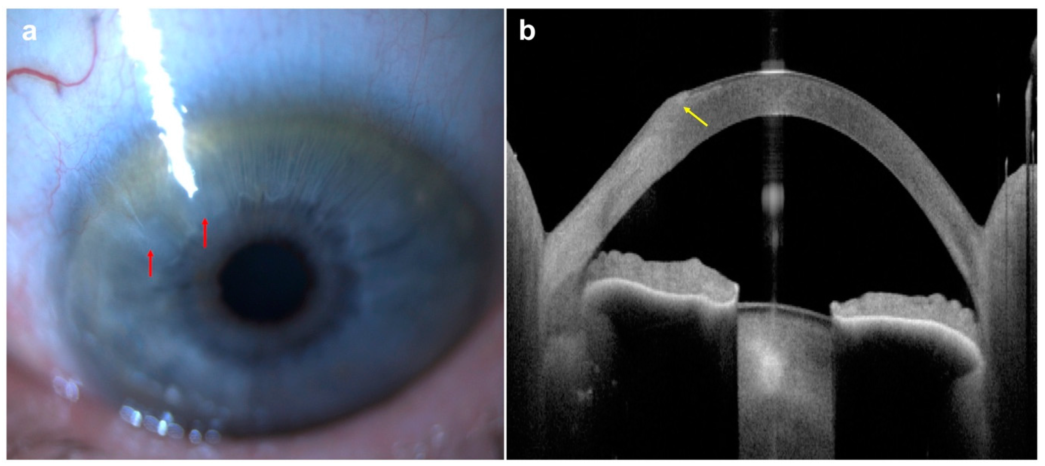 Diagnostics 14 00122 g006 Diagnostics 14 00122 g006