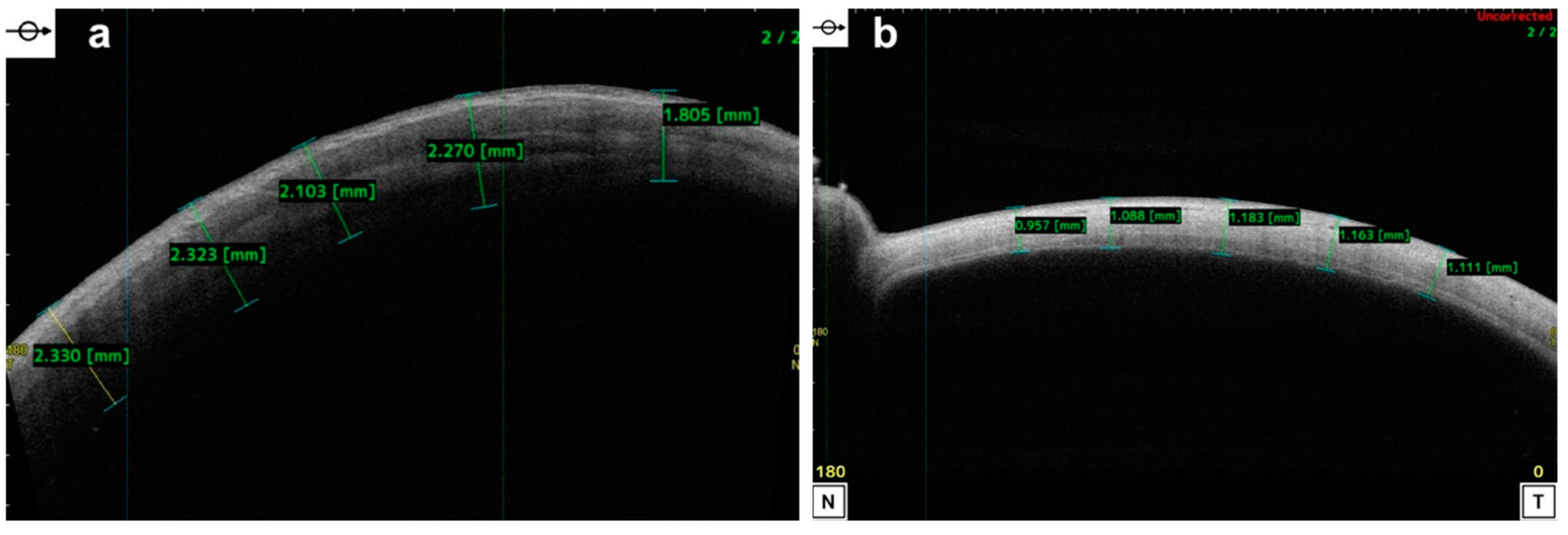 Diagnostics 14 00122 g007 Diagnostics 14 00122 g007