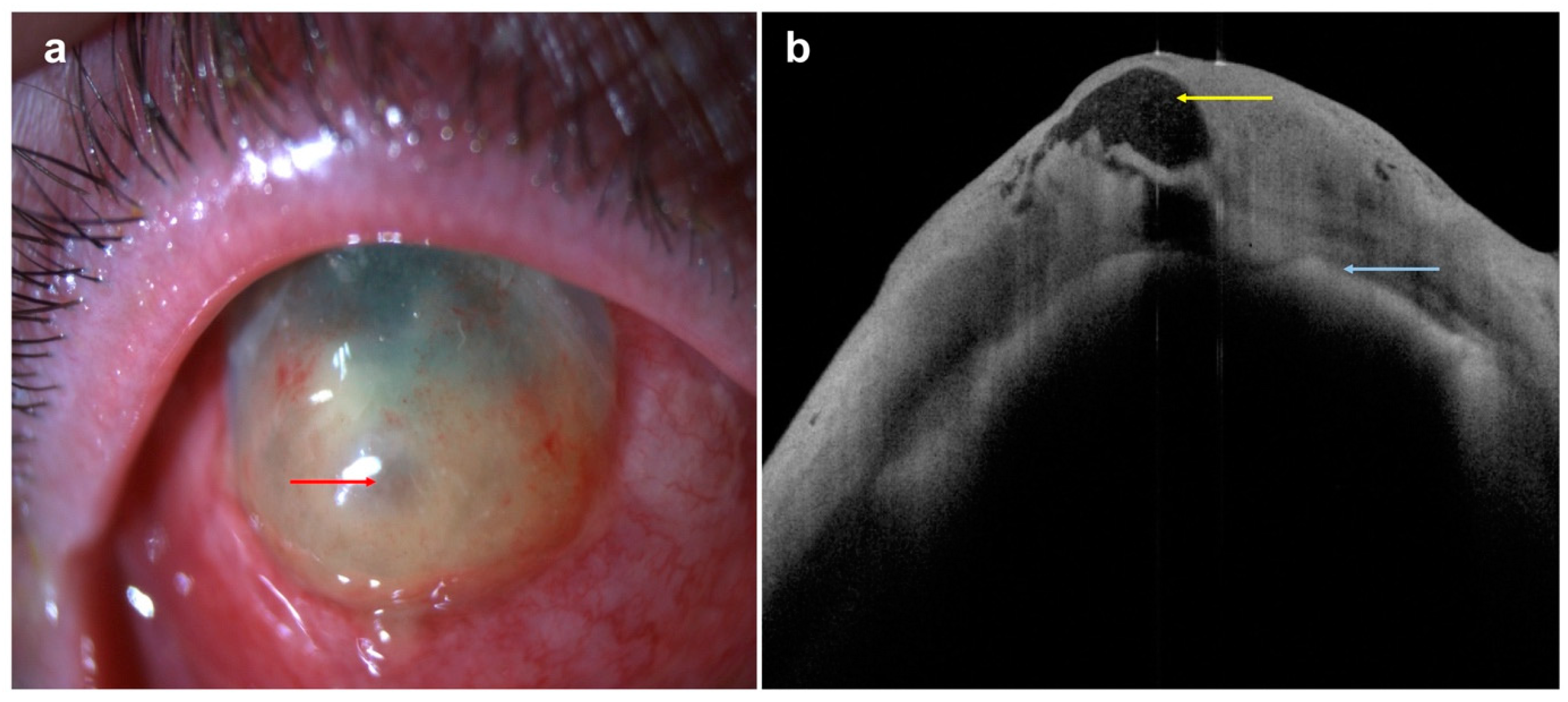 Diagnostics 14 00122 g009 Diagnostics 14 00122 g009