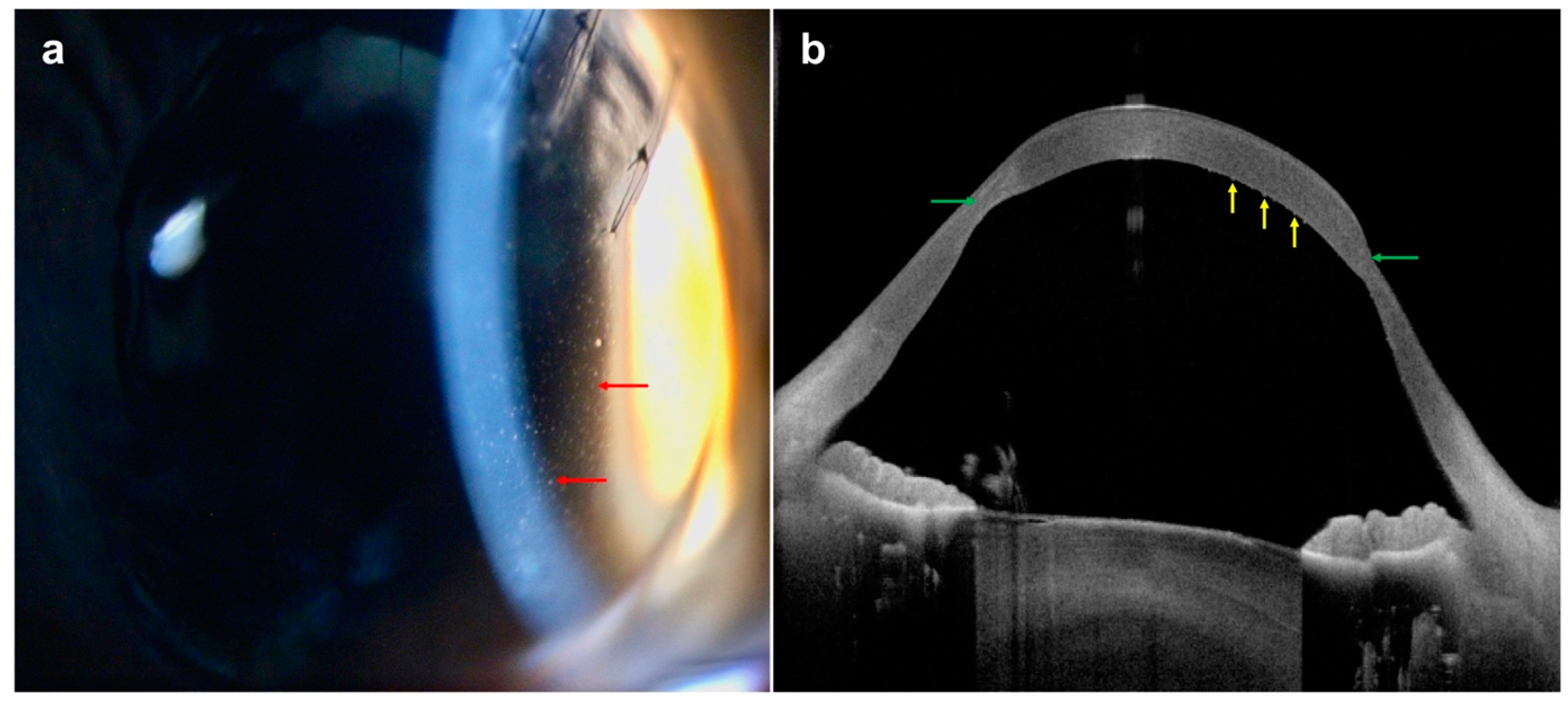 Diagnostics 14 00122 g012 Diagnostics 14 00122 g012