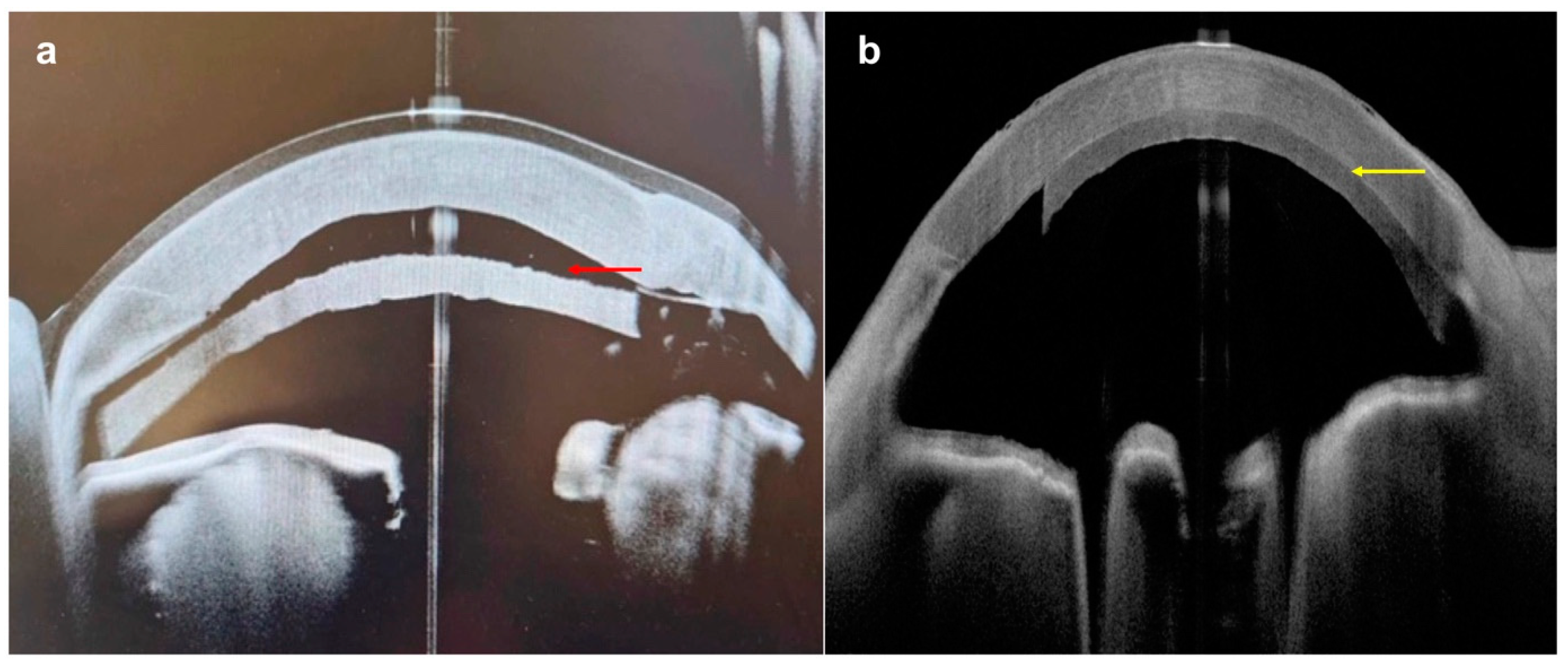 Diagnostics 14 00122 g013 Diagnostics 14 00122 g013