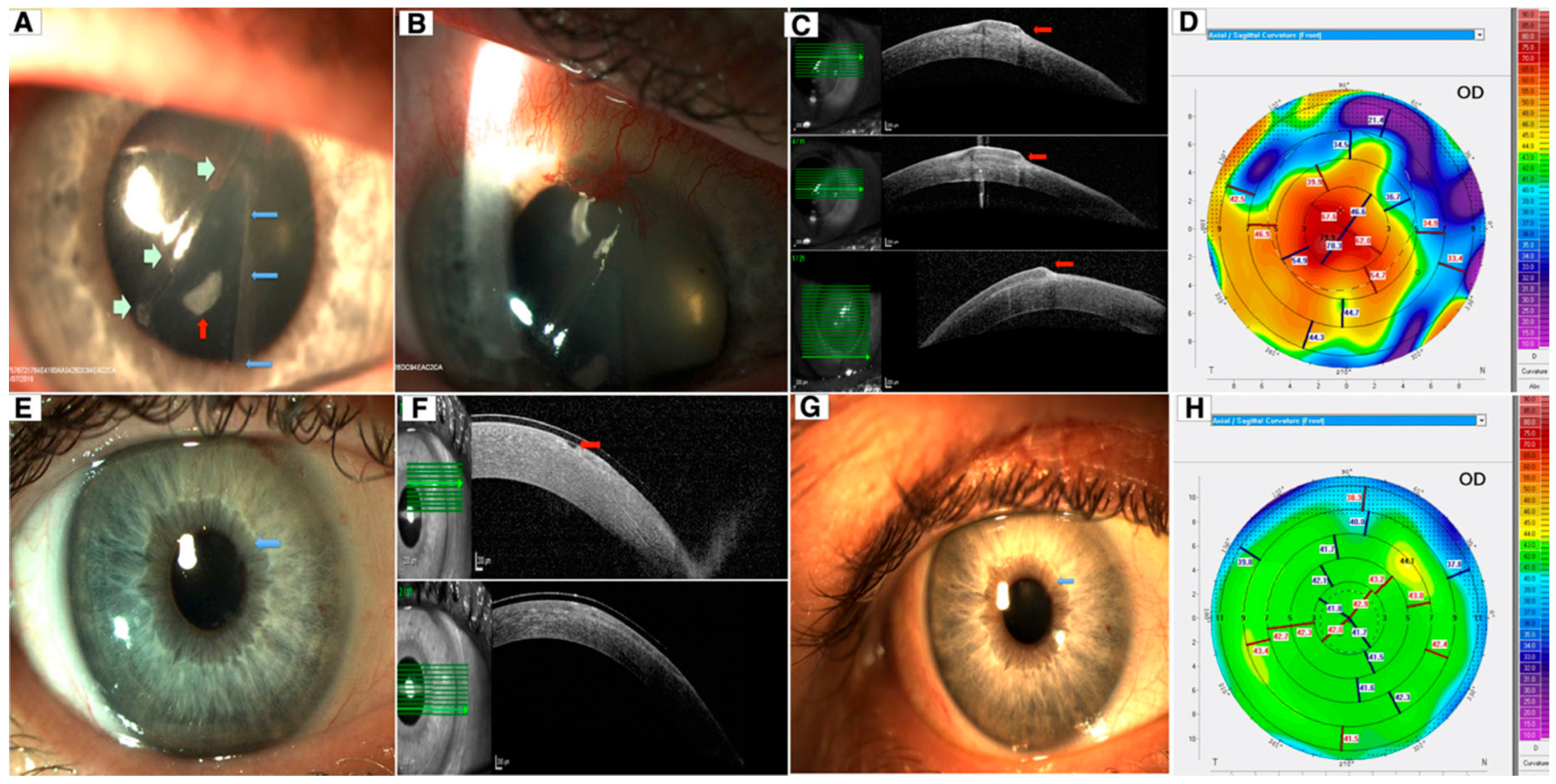 Diagnostics 14 00122 g015 Diagnostics 14 00122 g015