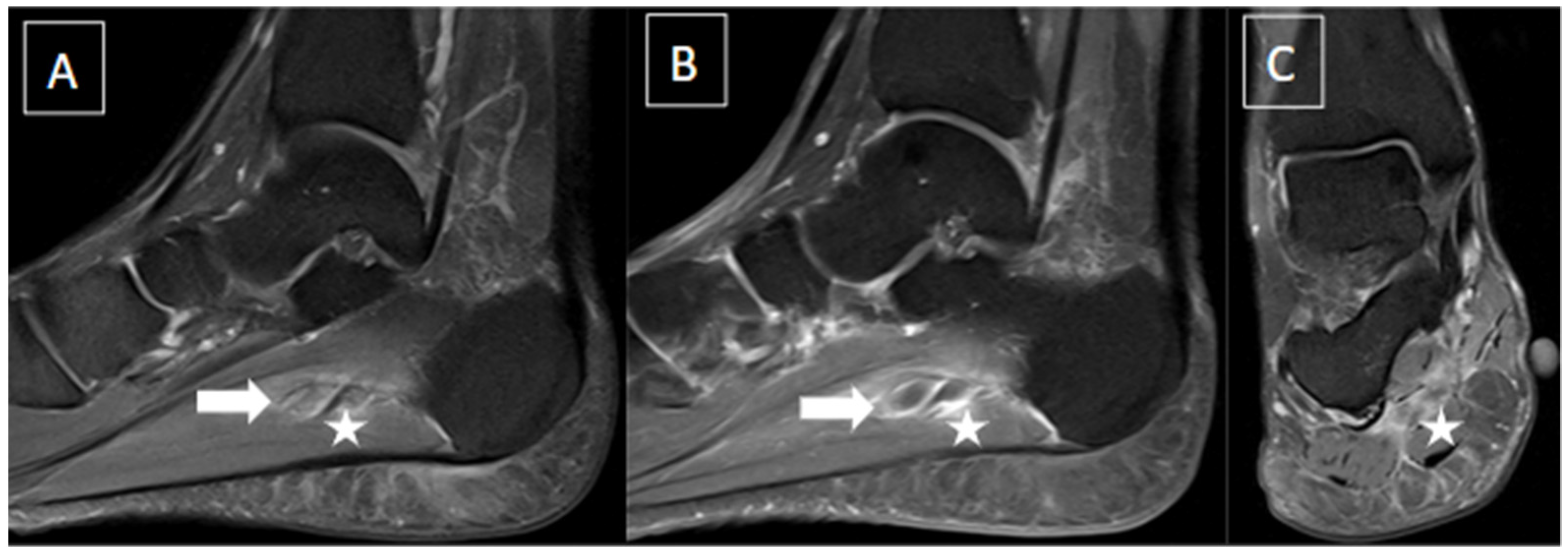 Diagnostics 14 00126 g002