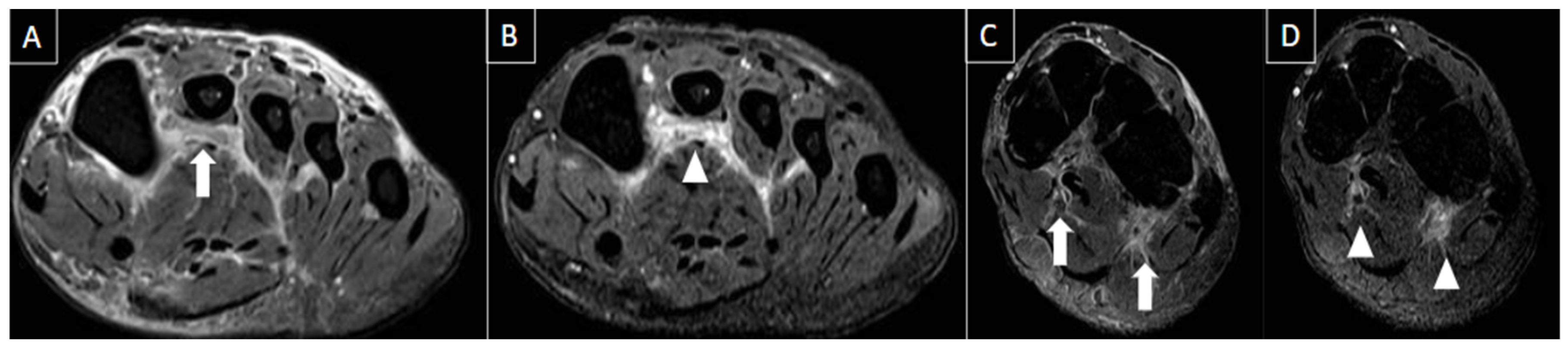 Diagnostics 14 00126 g004
