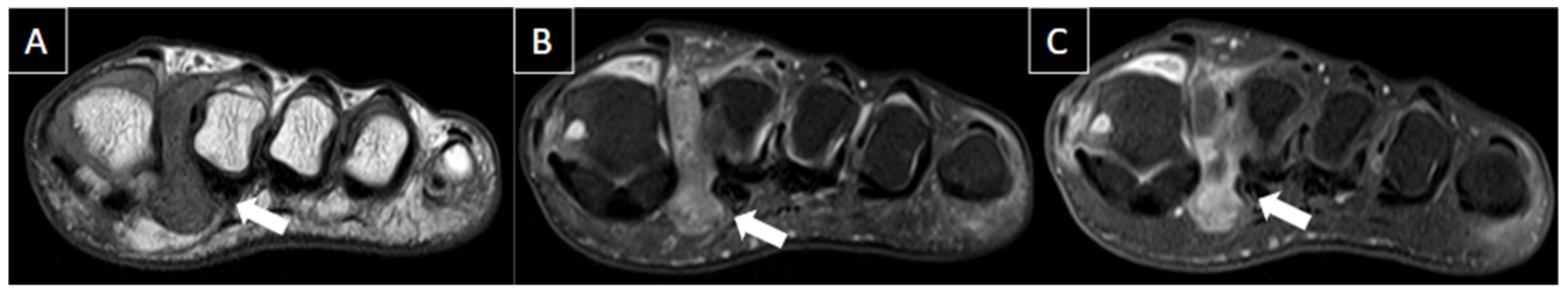 Diagnostics 14 00126 g005