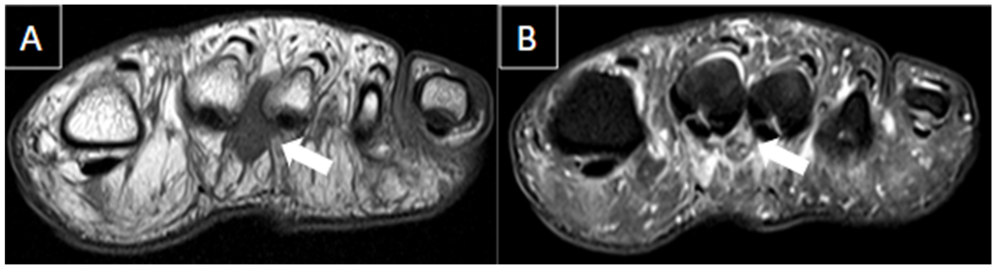 Diagnostics 14 00126 g006