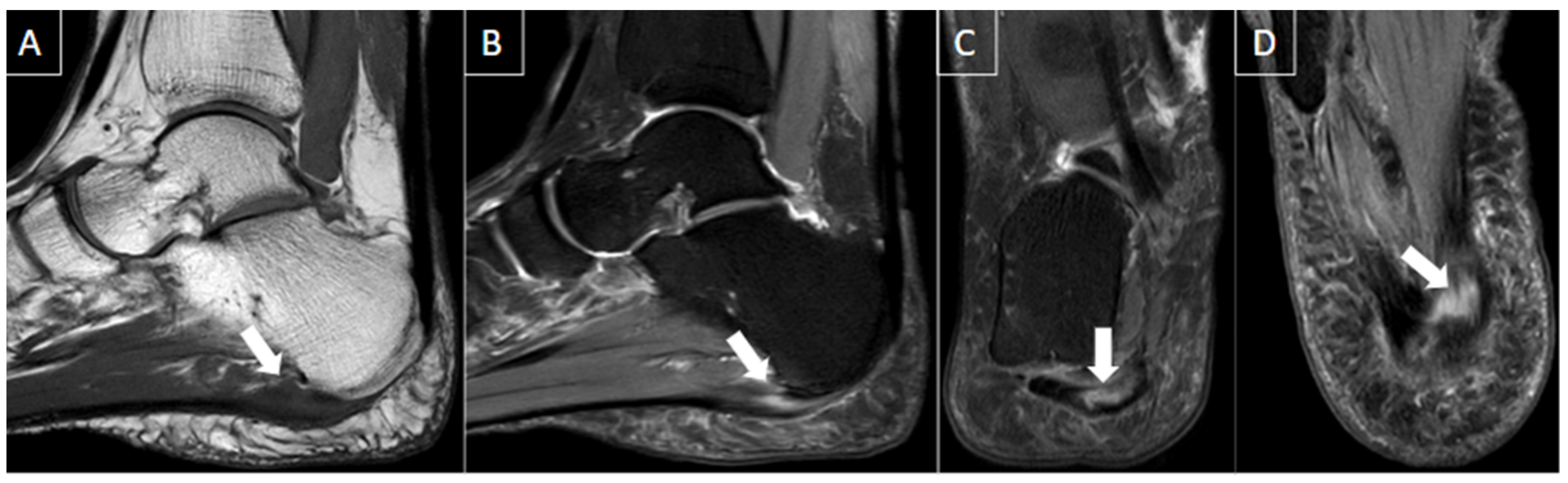Diagnostics 14 00126 g008