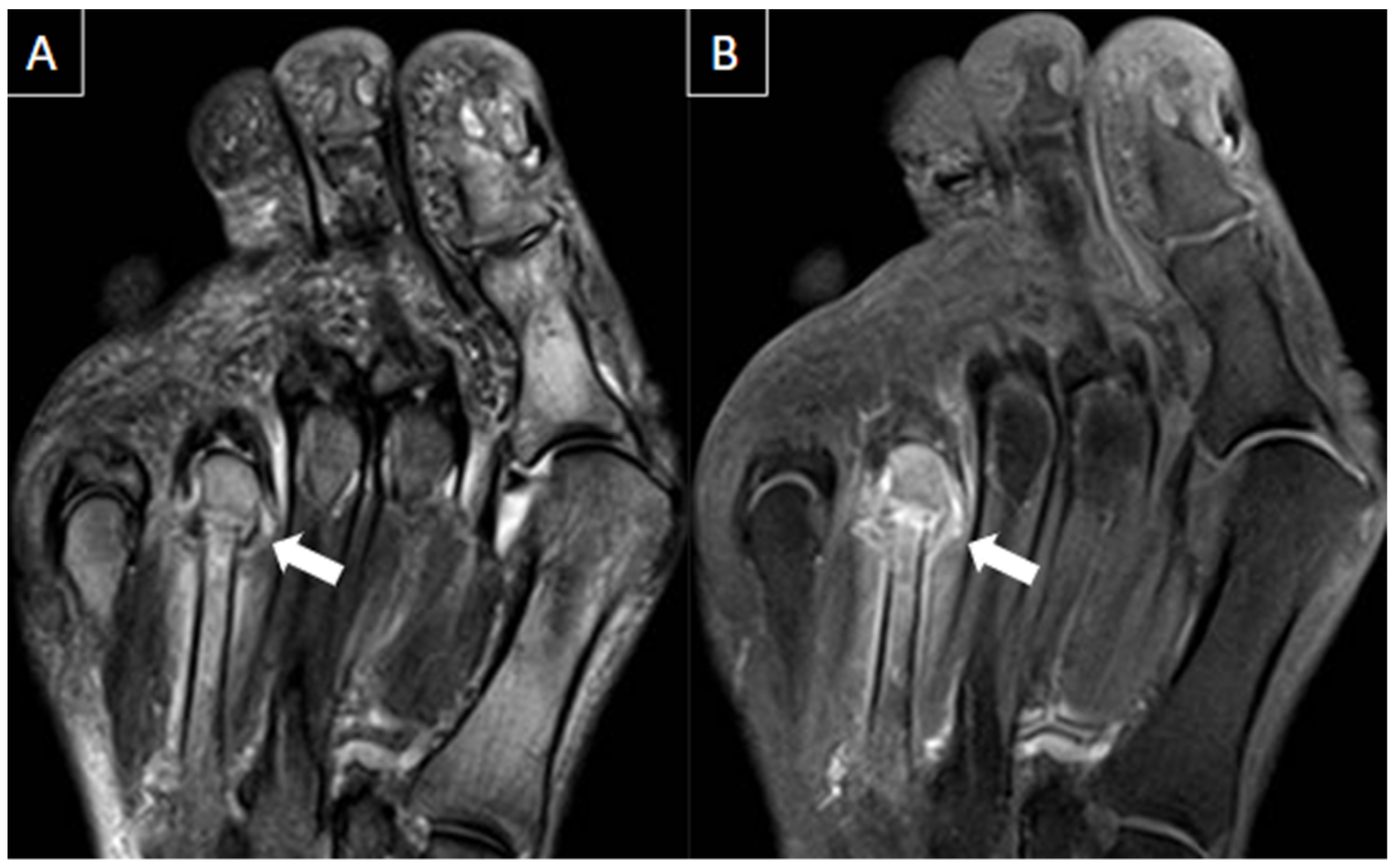 Diagnostics 14 00126 g012