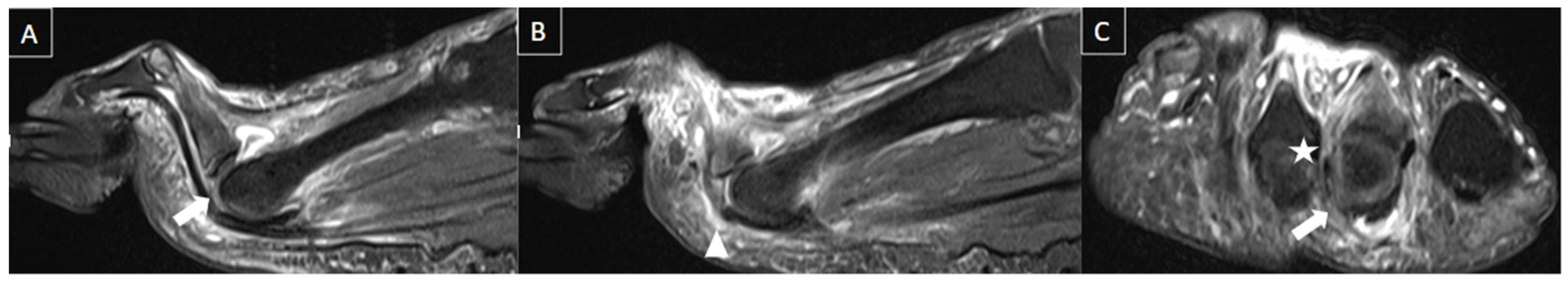 Diagnostics 14 00126 g013