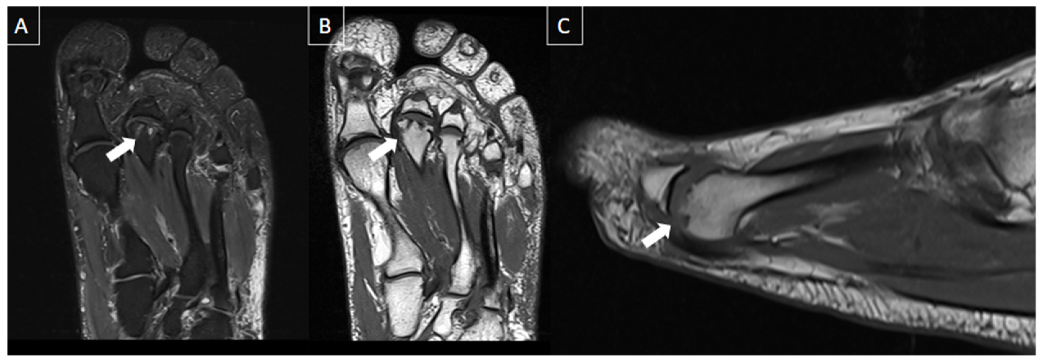 Diagnostics 14 00126 g014