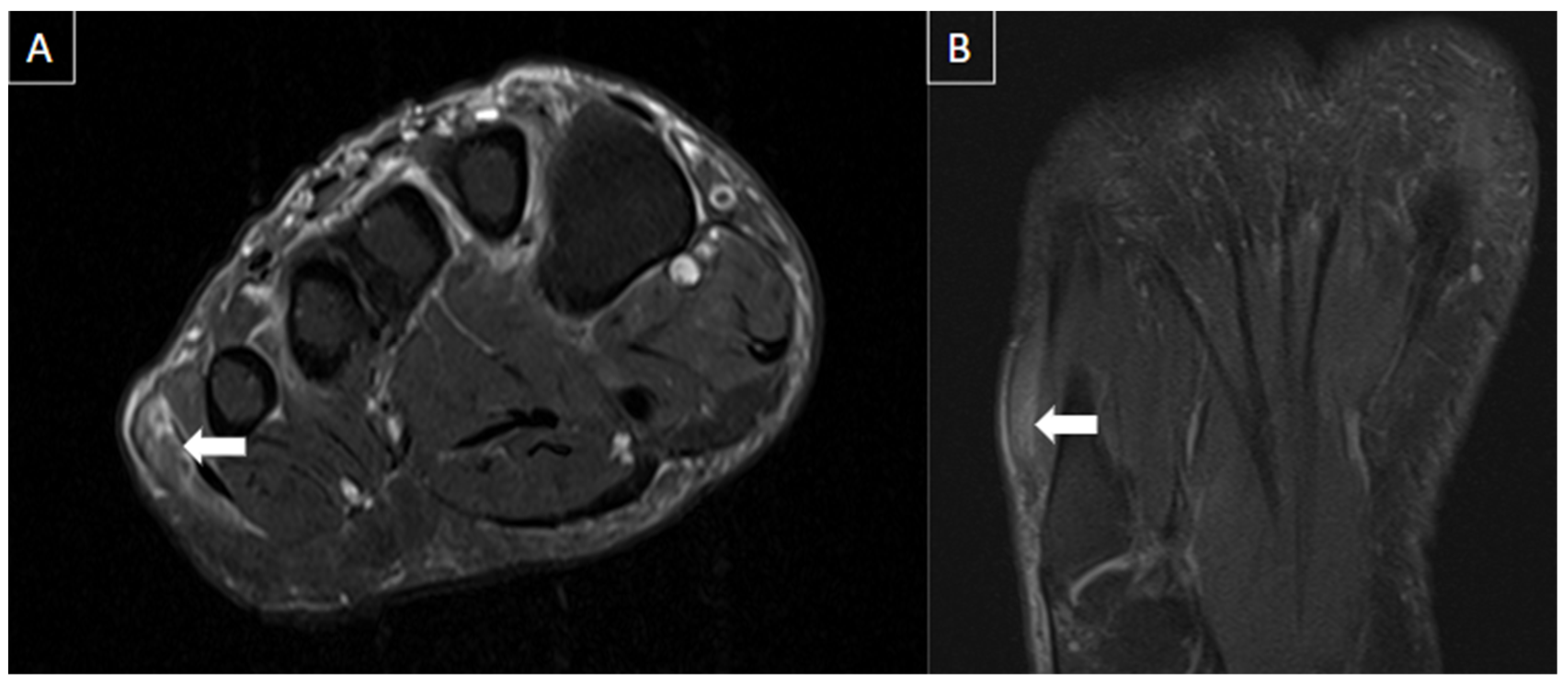 Diagnostics 14 00126 g016