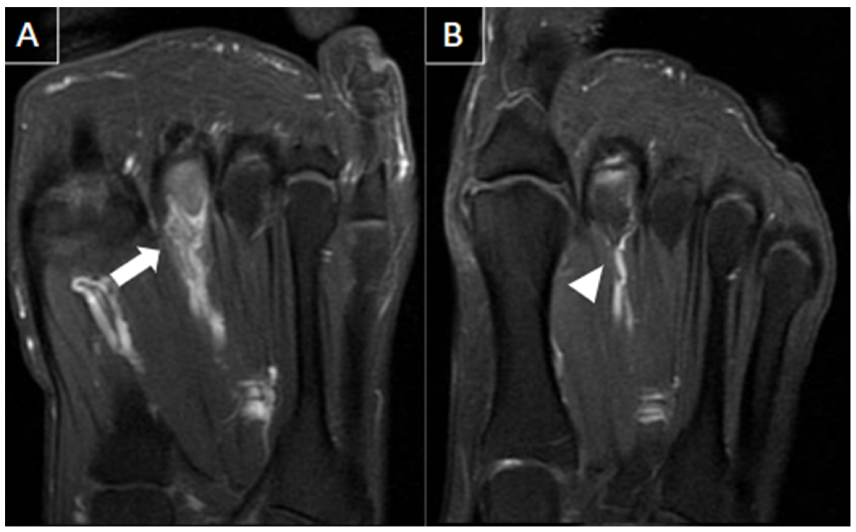 Diagnostics 14 00126 g017