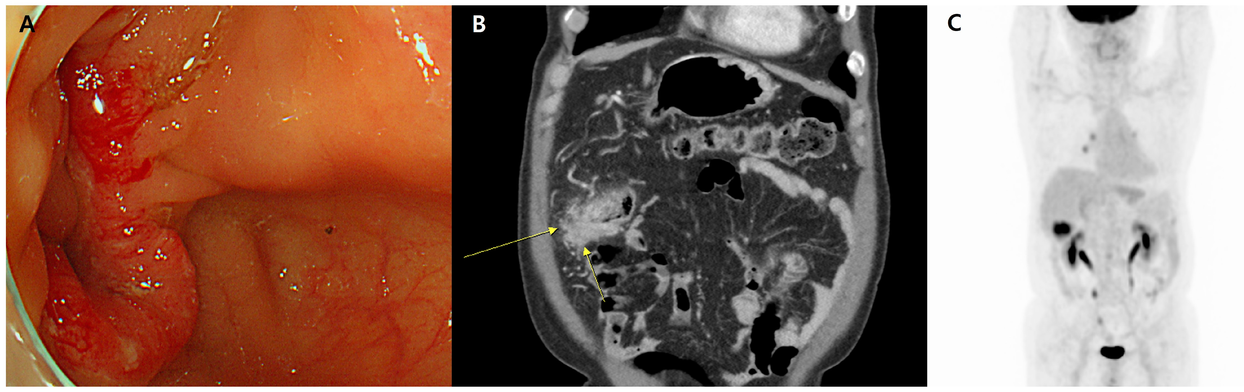 Diagnostics 14 00138 g001