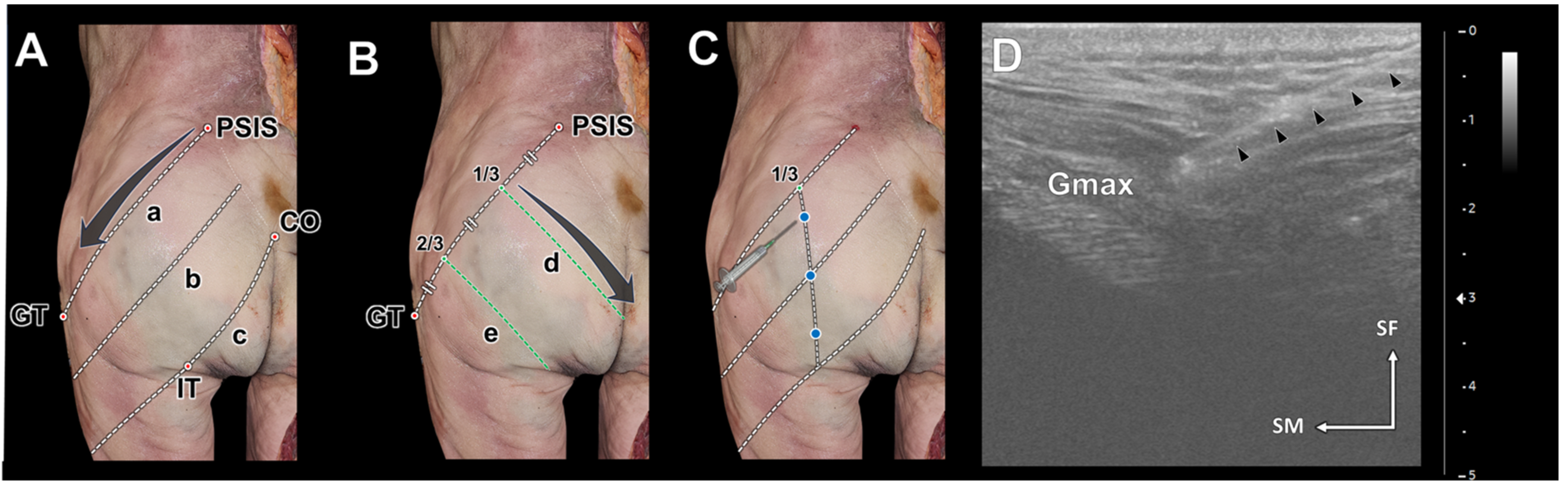 Diagnostics 14 00140 g002