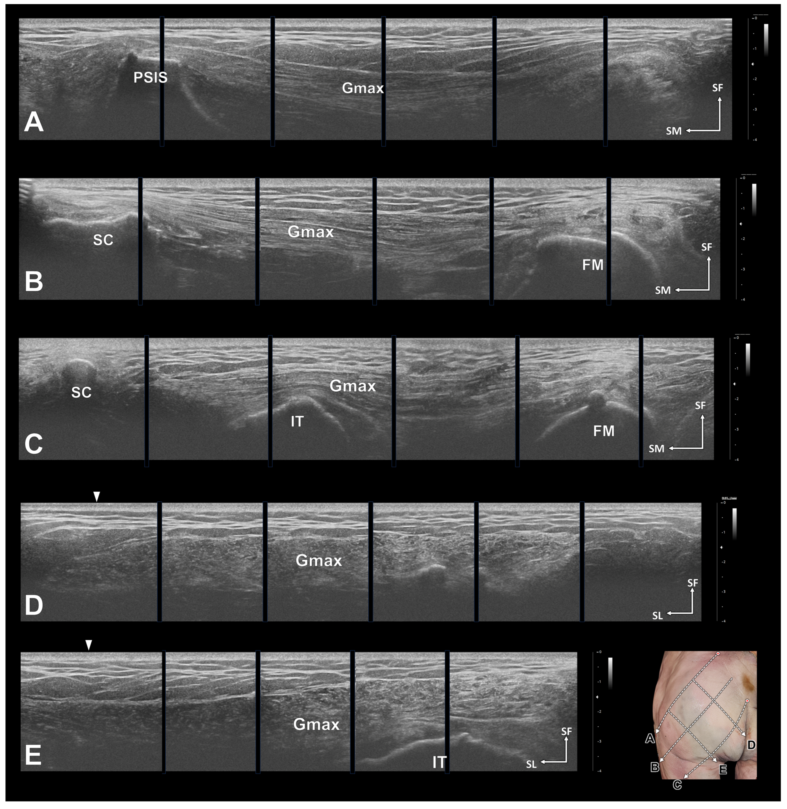 Diagnostics 14 00140 g004