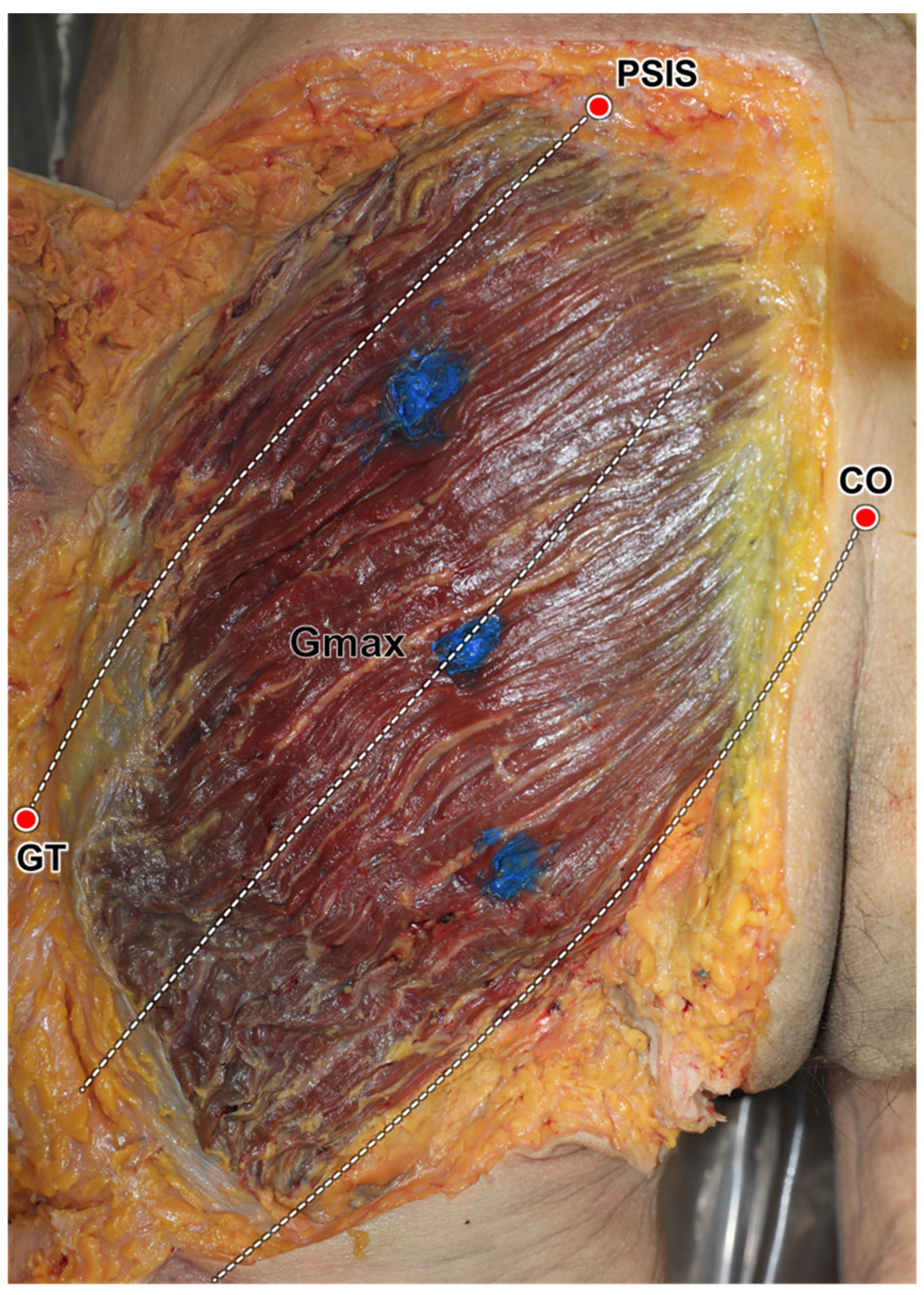 Diagnostics 14 00140 g005