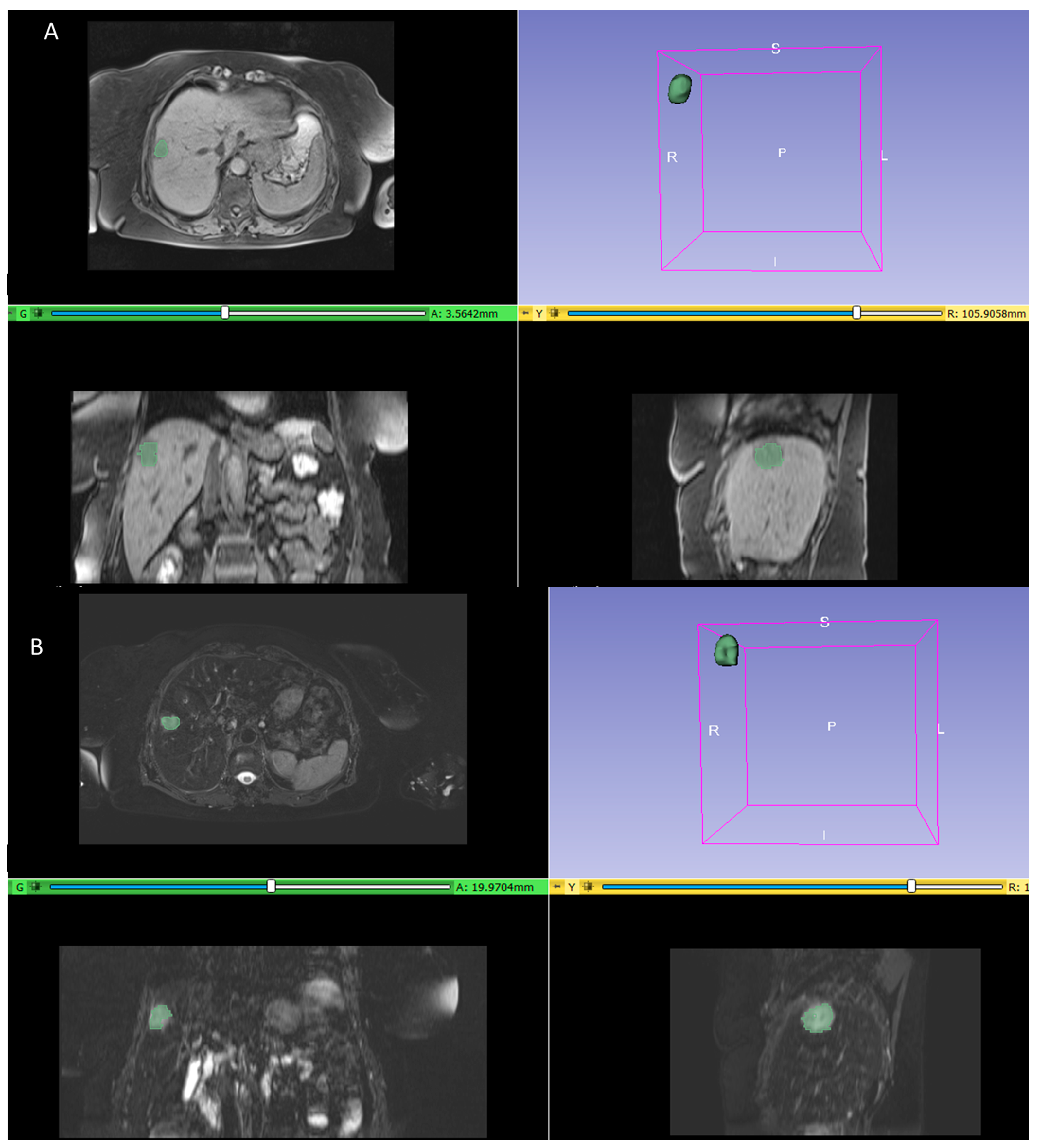 Diagnostics 14 00152 g001
