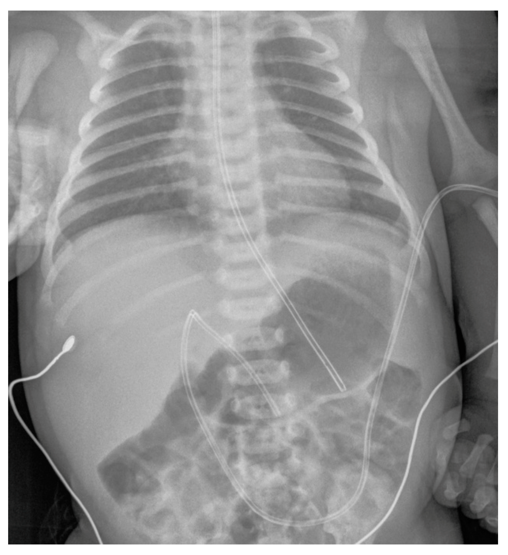 Diagnostics 14 00157 g006