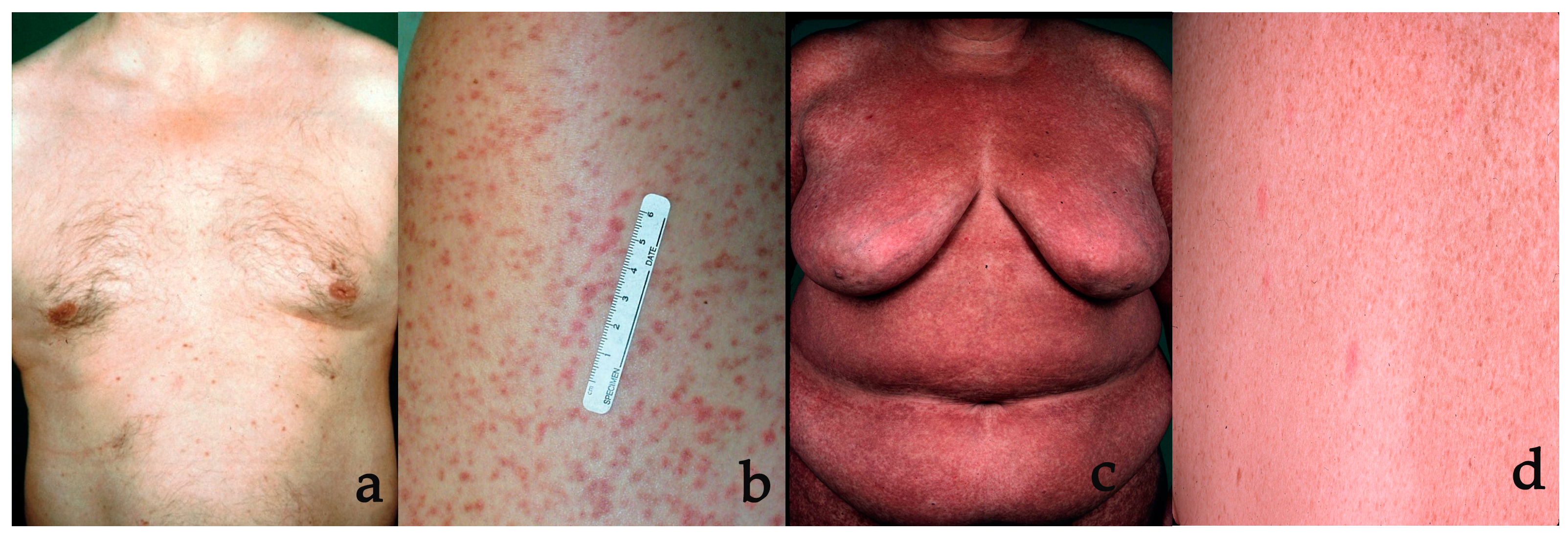 Diagnostics 14 00161 g002