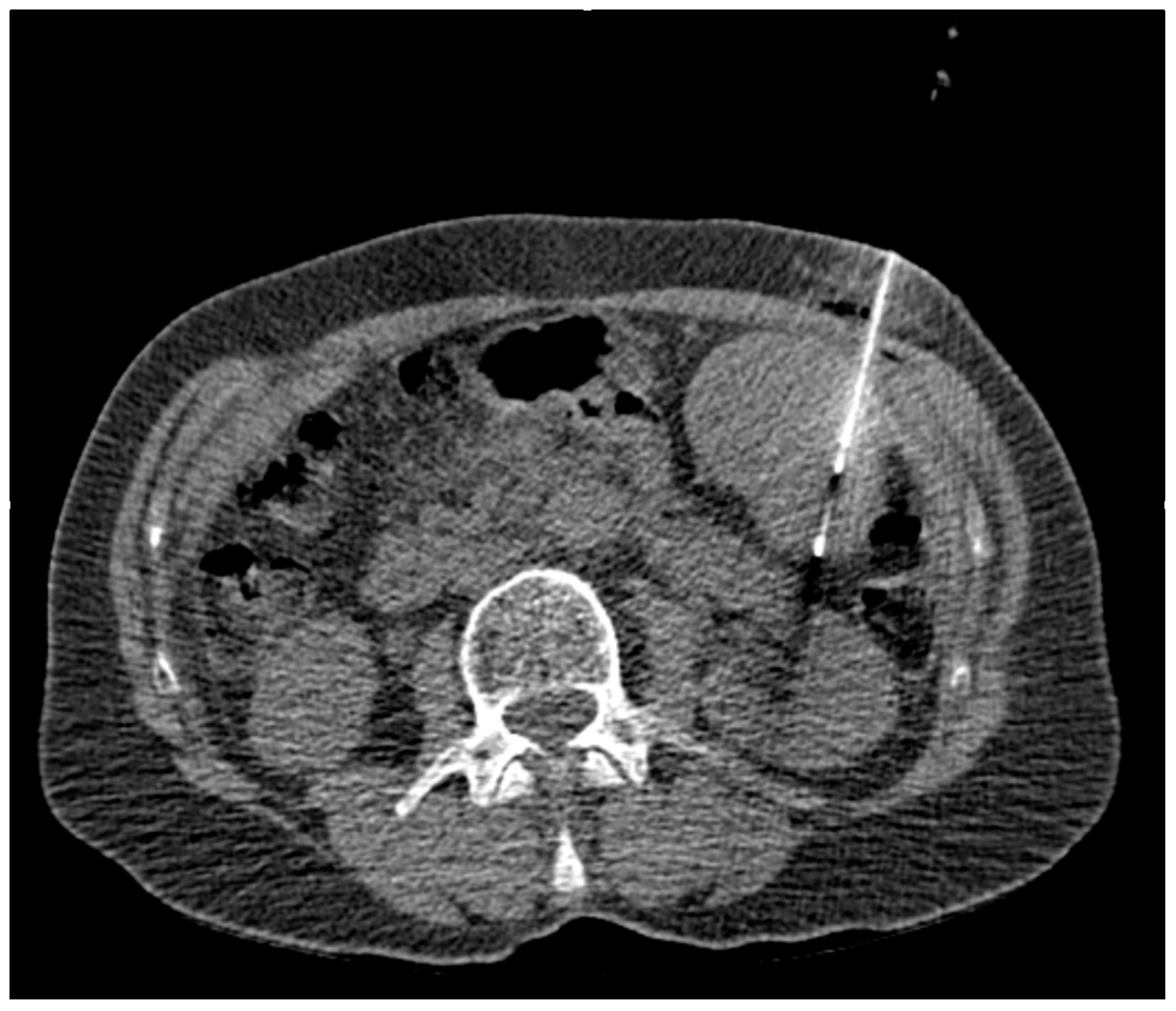 Diagnostics 14 00162 g002 Diagnostics 14 00162 g002