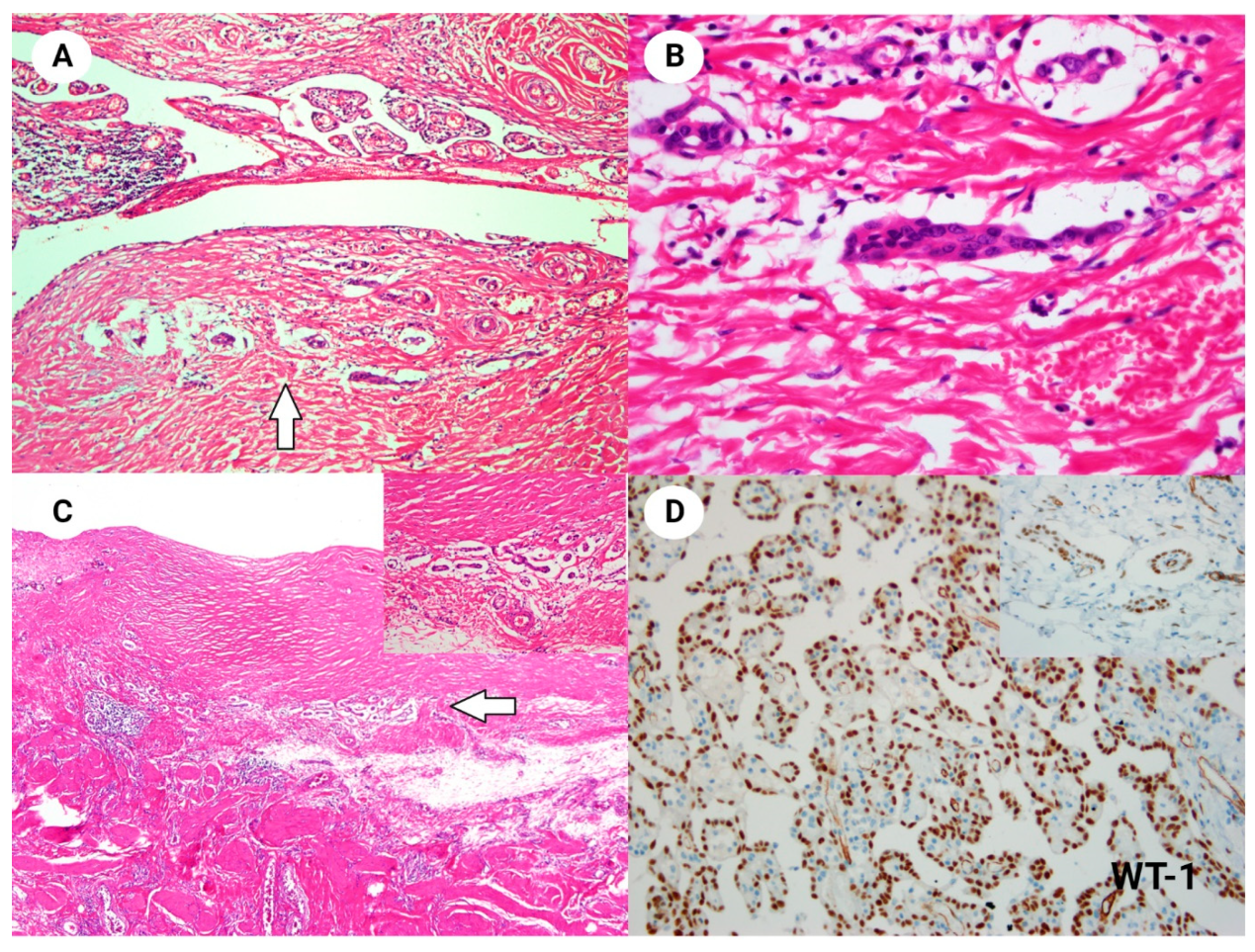 Diagnostics 14 00169 g002