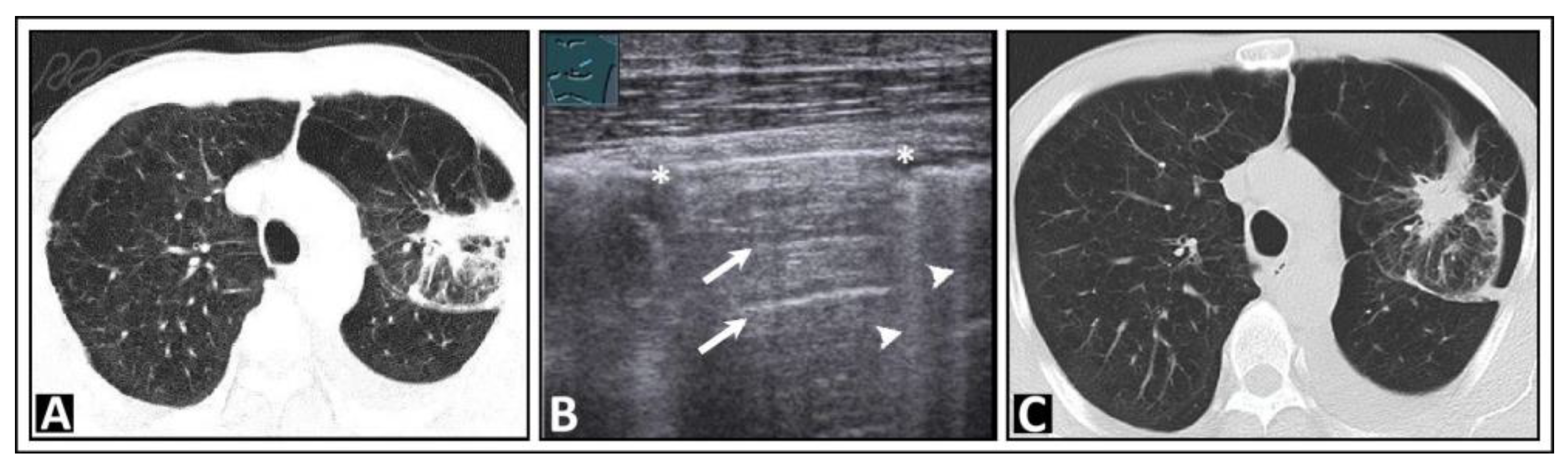 Diagnostics 14 00179 g003