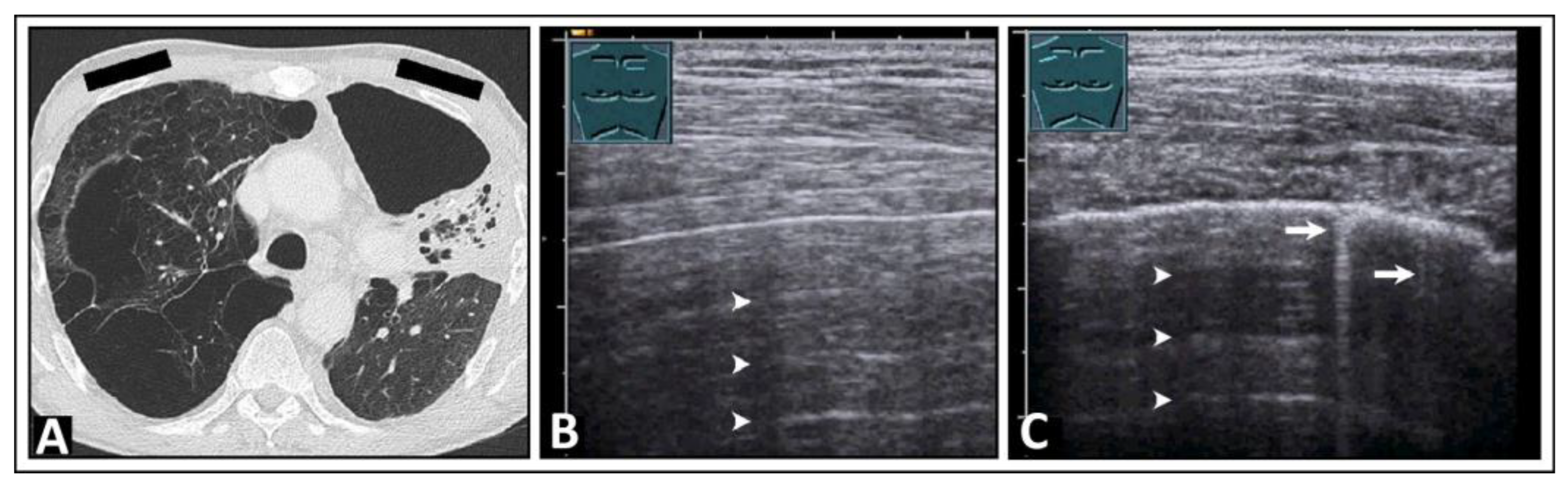 Diagnostics 14 00179 g004