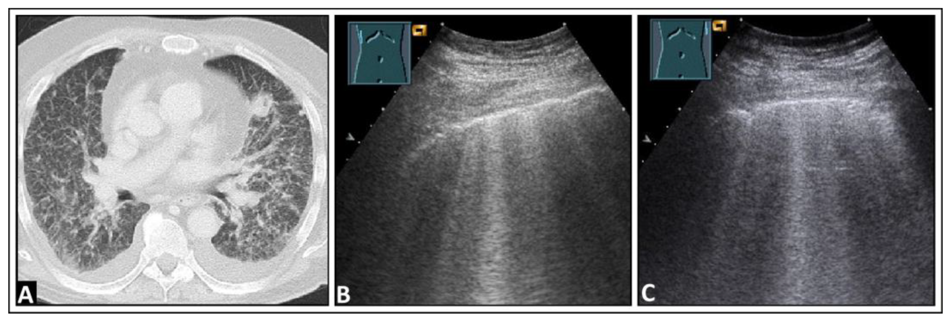 Diagnostics 14 00179 g013