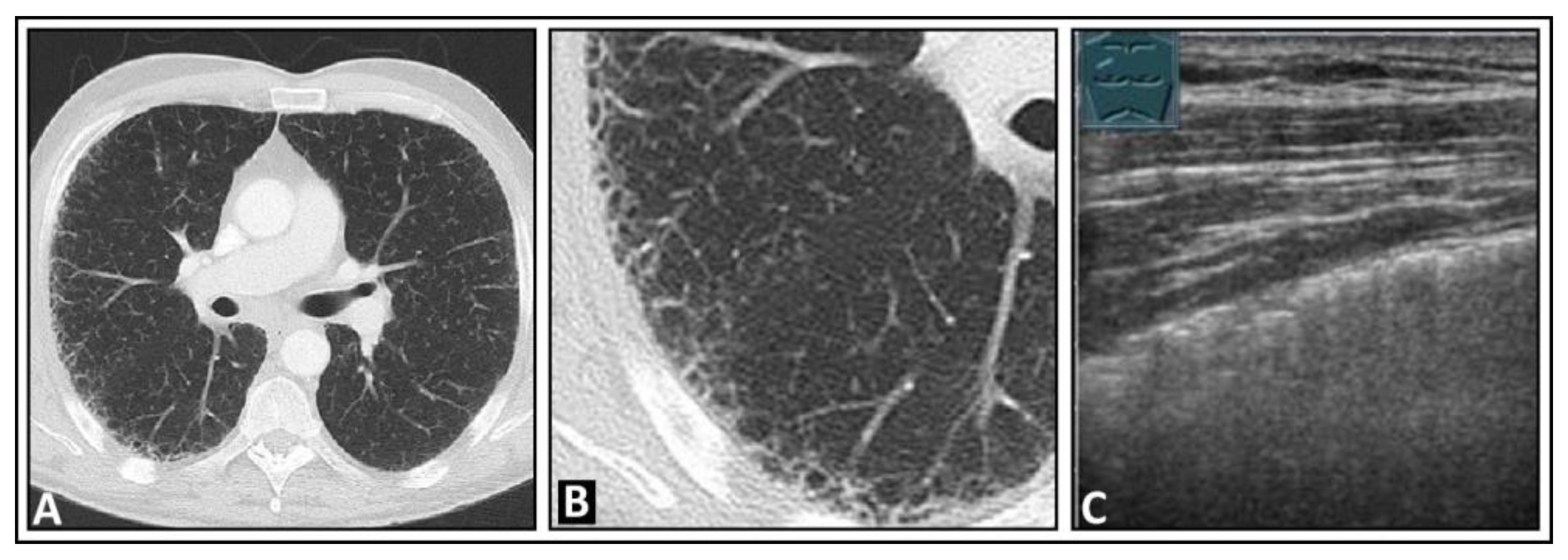 Diagnostics 14 00179 g016