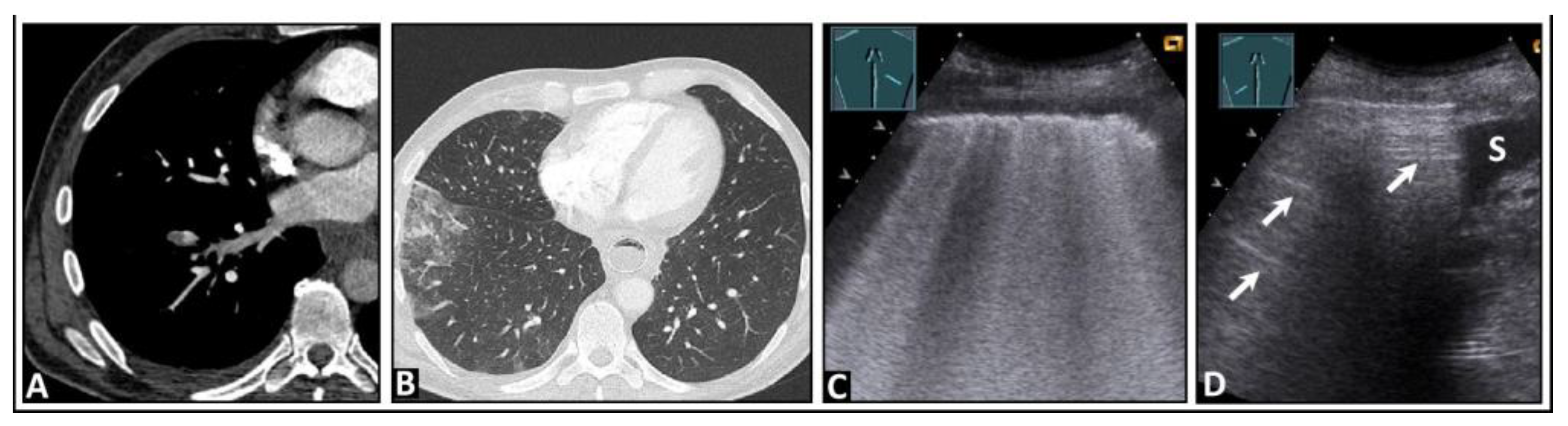 Diagnostics 14 00179 g017