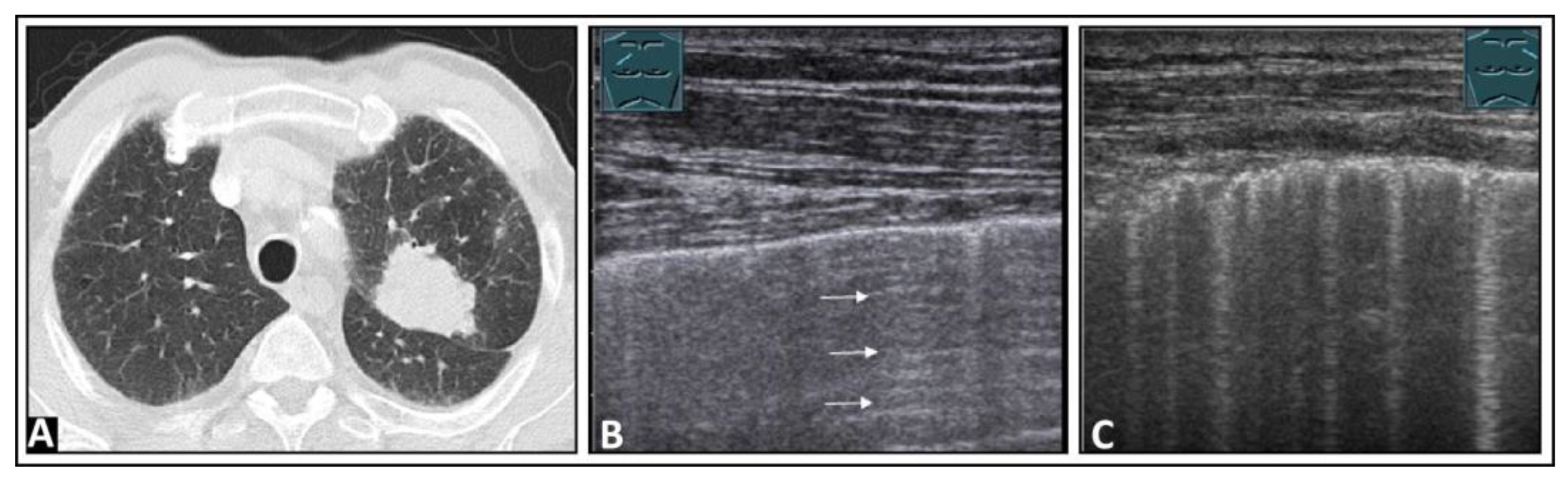 Diagnostics 14 00179 g018