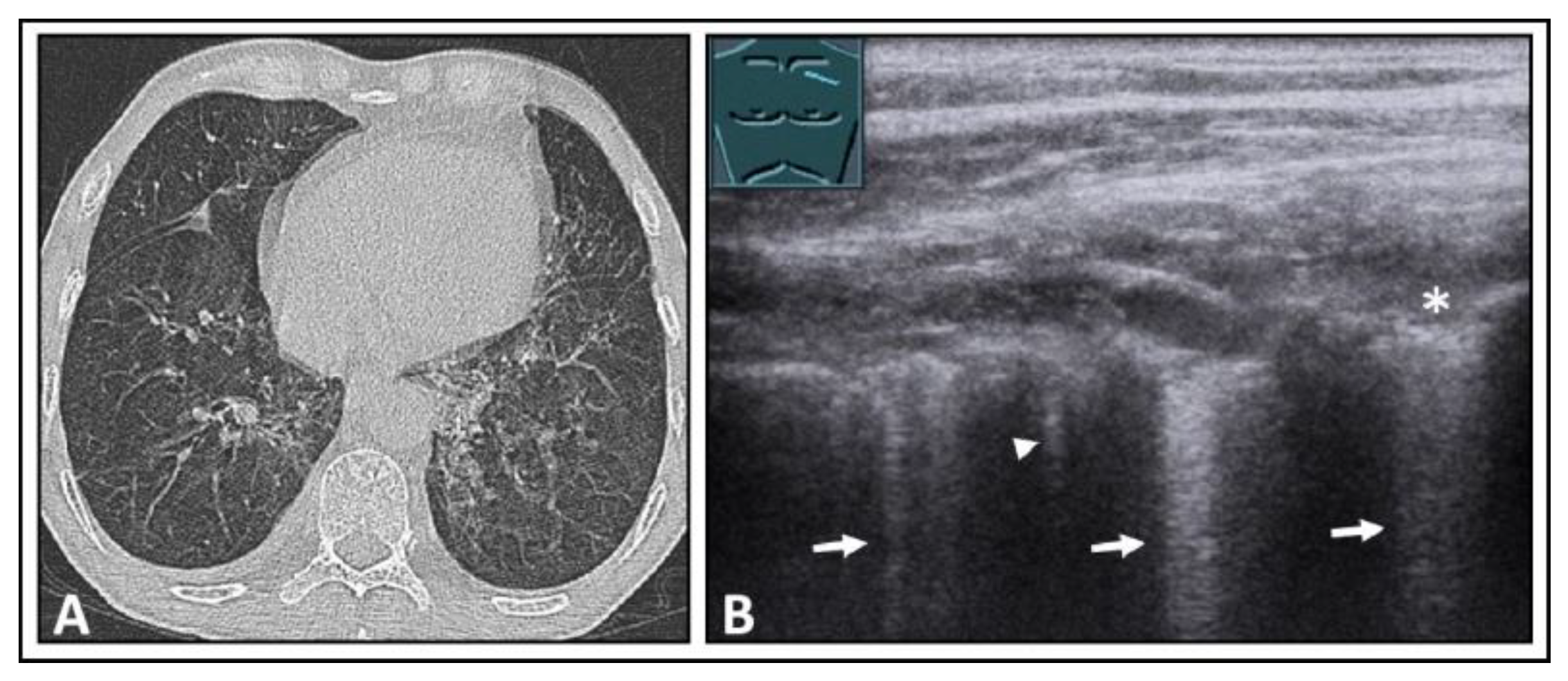 Diagnostics 14 00179 g022