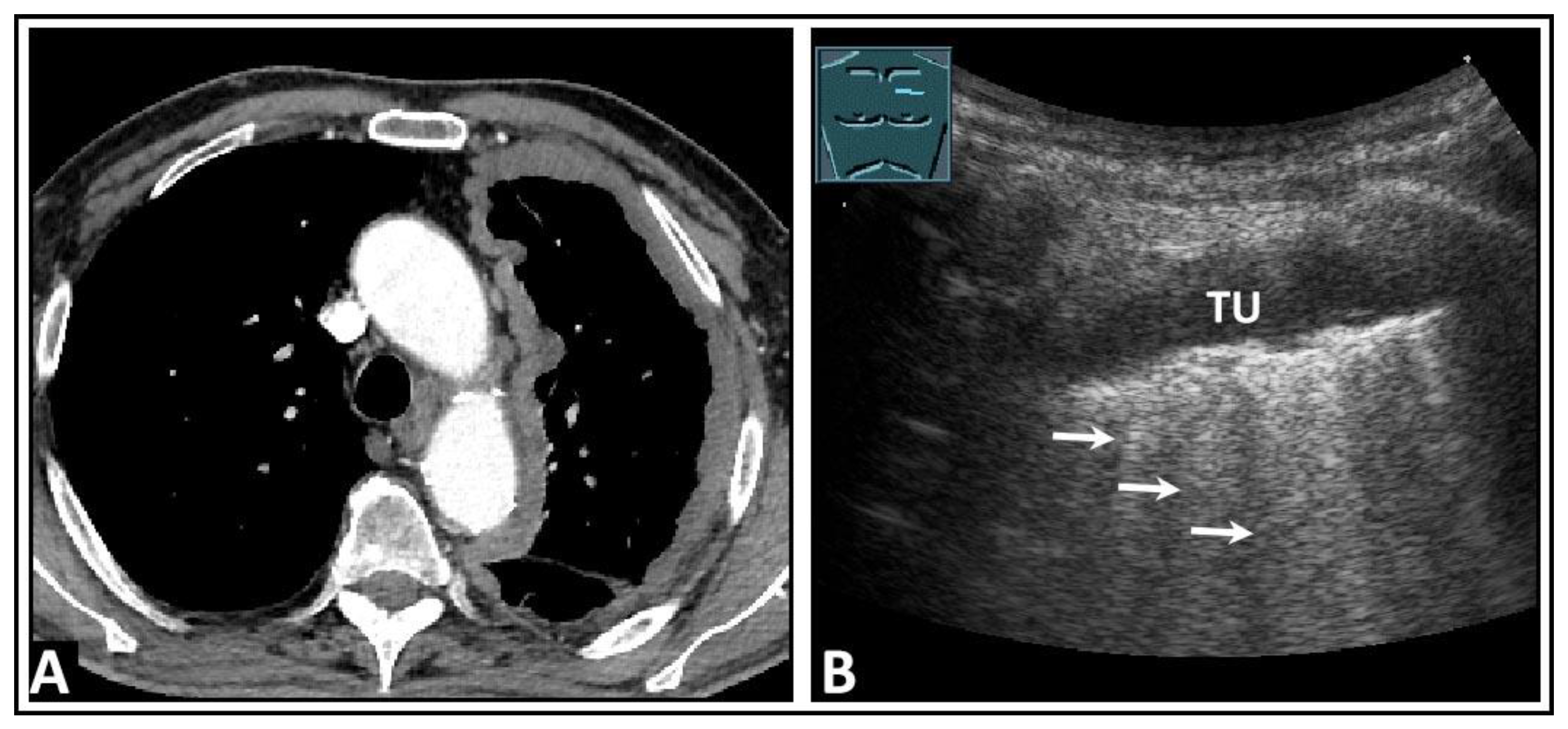 Diagnostics 14 00179 g024