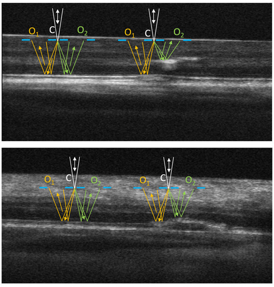 Motion Contrast, Phase Gradient, and Simultaneous OCT Images Assist in ...