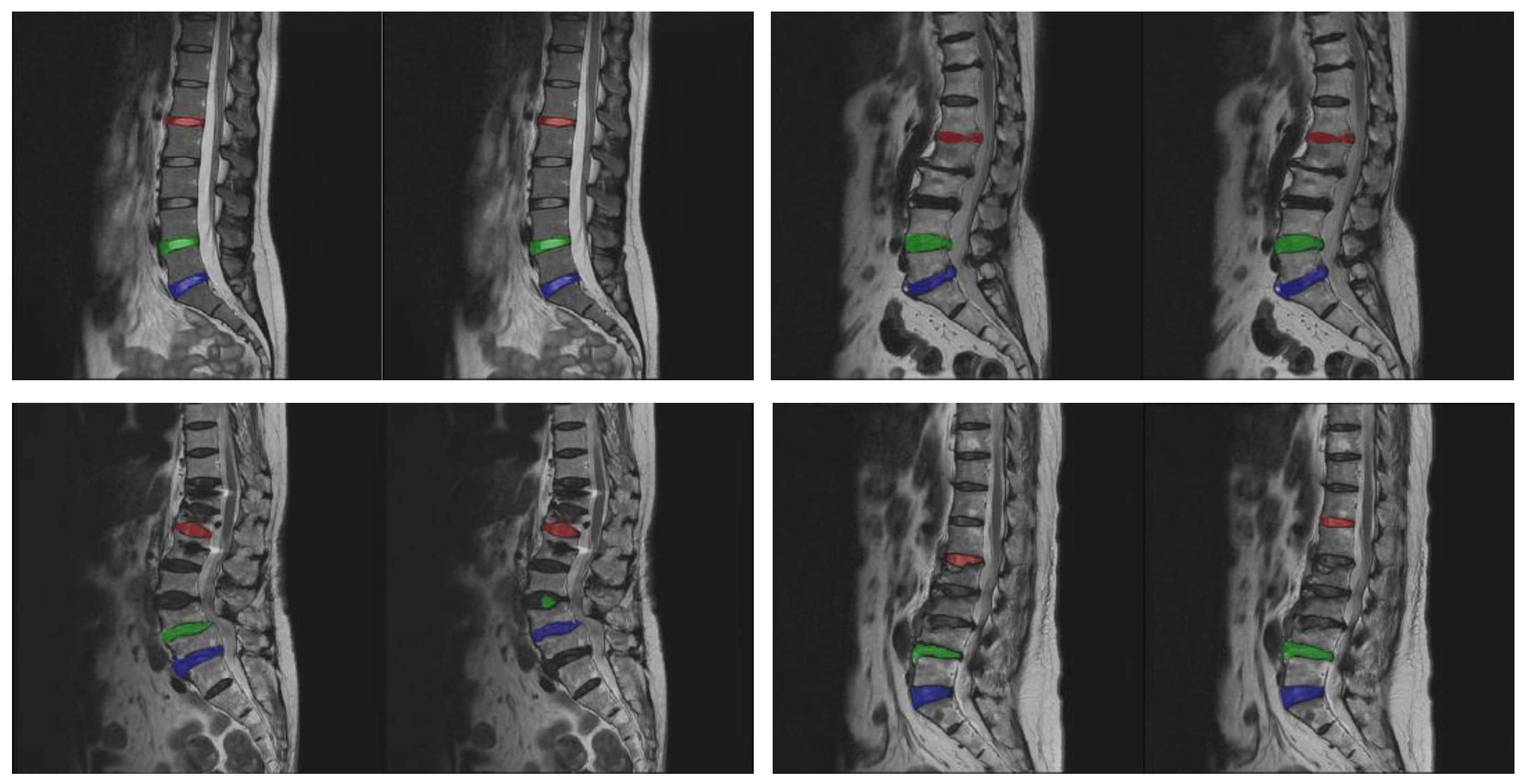 Diagnostics 14 00191 g008