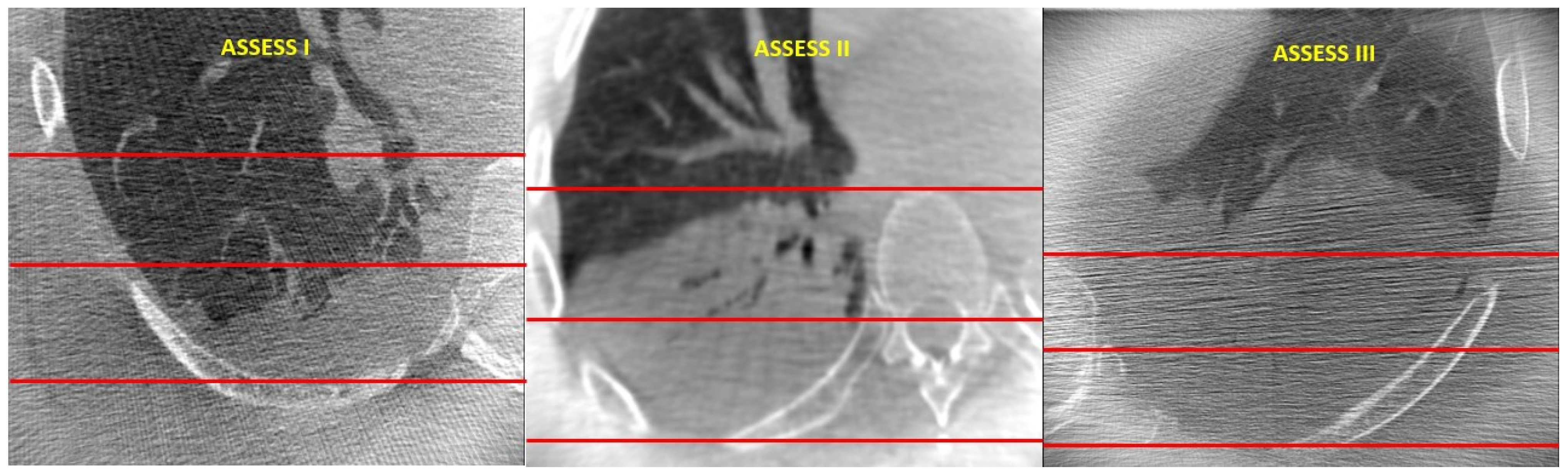 Diagnostics 14 00197 g002