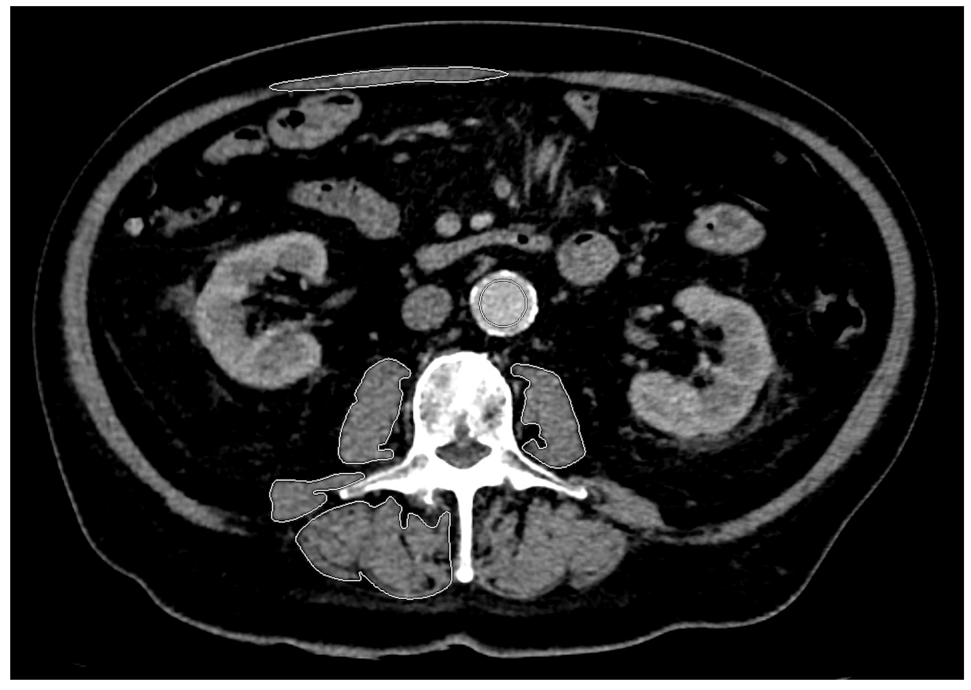 Diagnostics 14 00198 g002