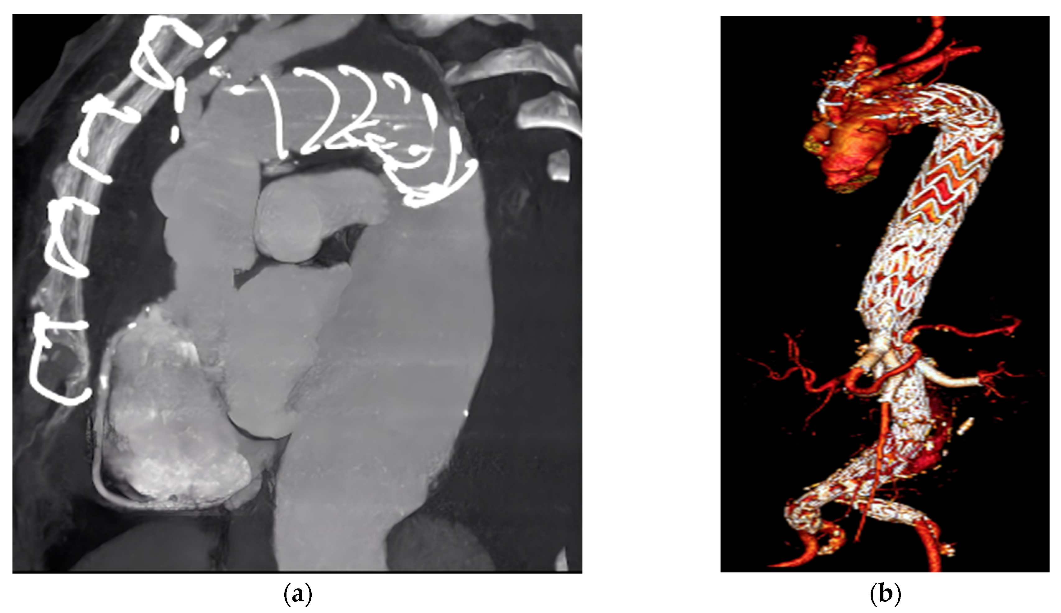 Diagnostics 14 00205 g001